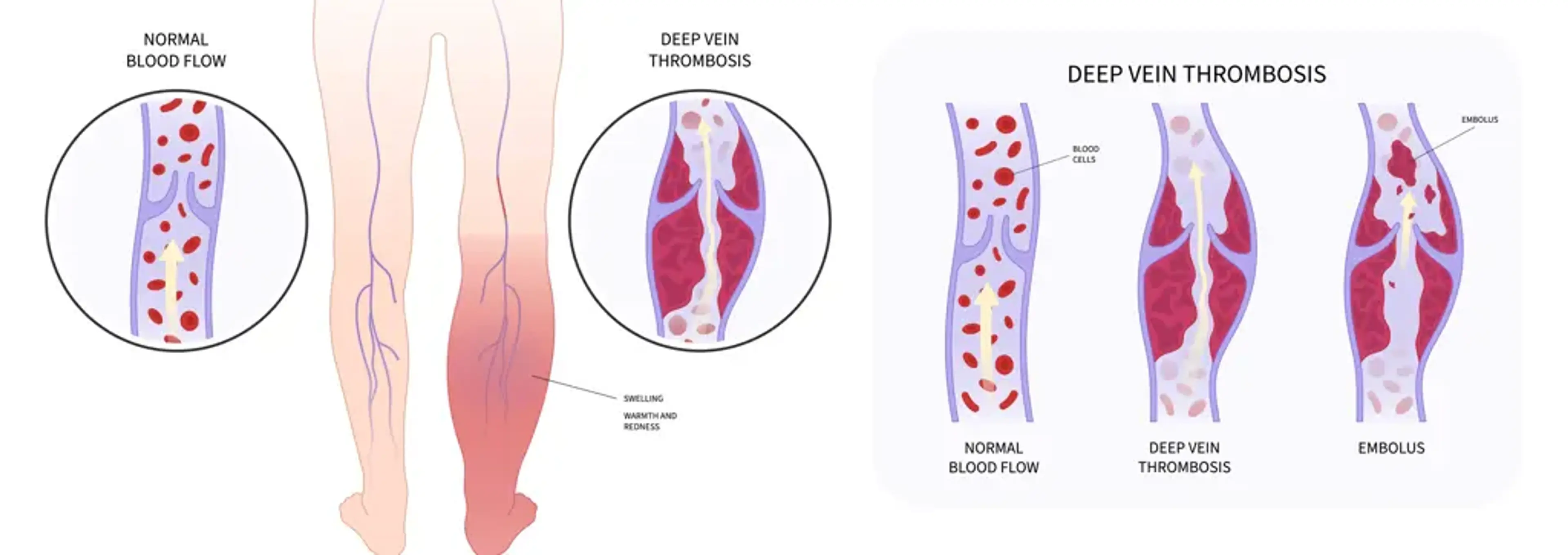 Charm Vascular Clinic
