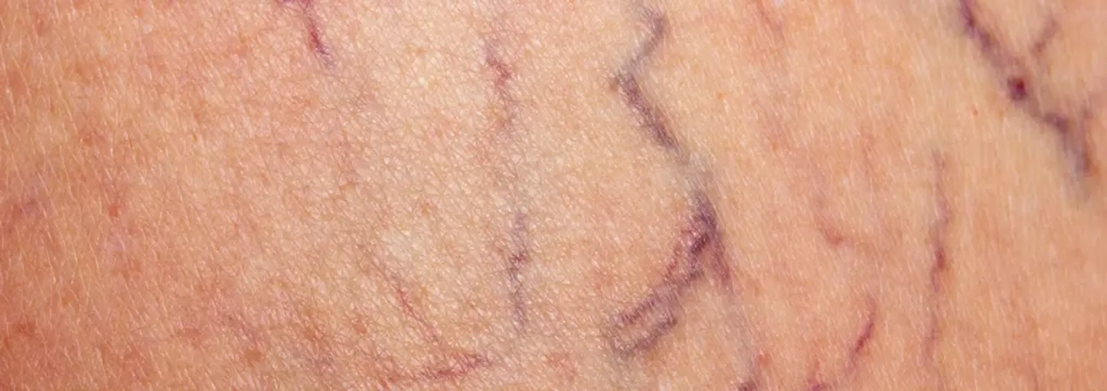 Charm Vascular Clinic