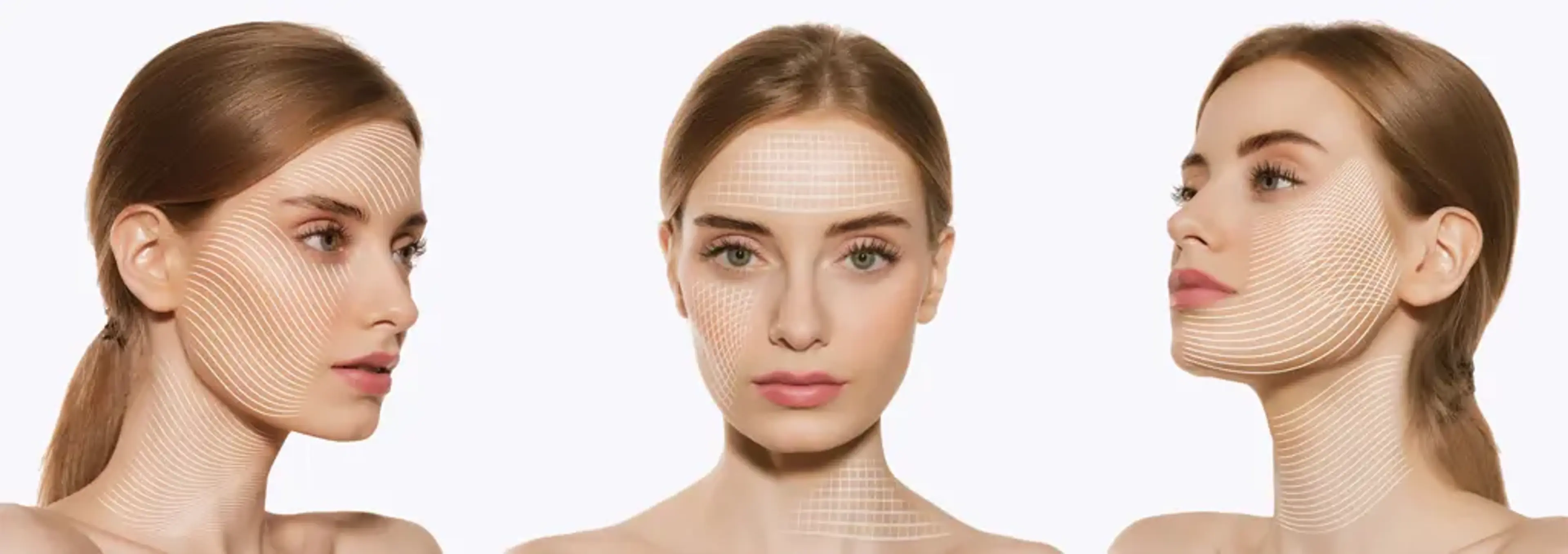 Hyalase Explained: When and Why to Dissolve Hyaluronic Fillers