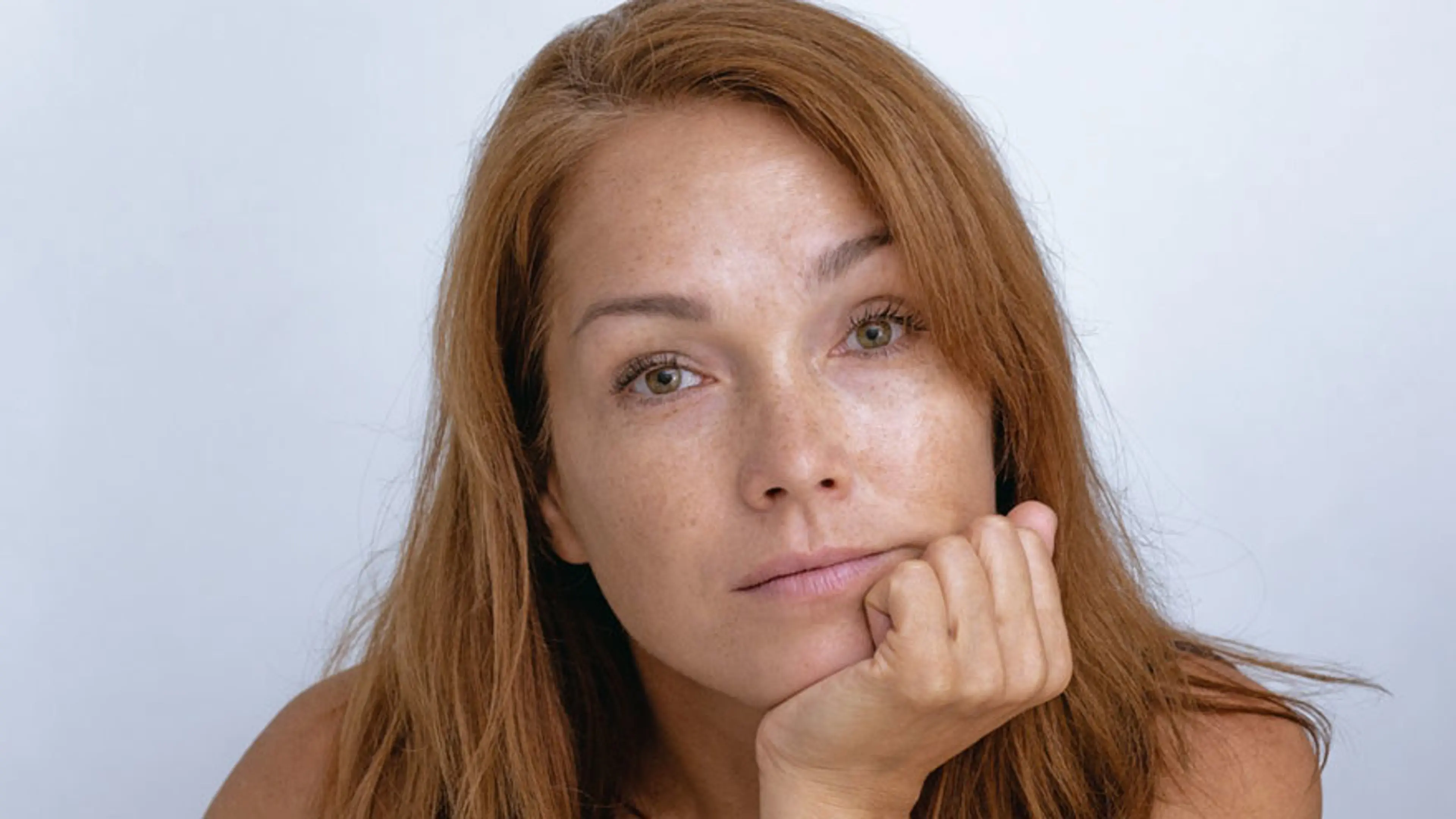 IPL 후 햇빛 노출