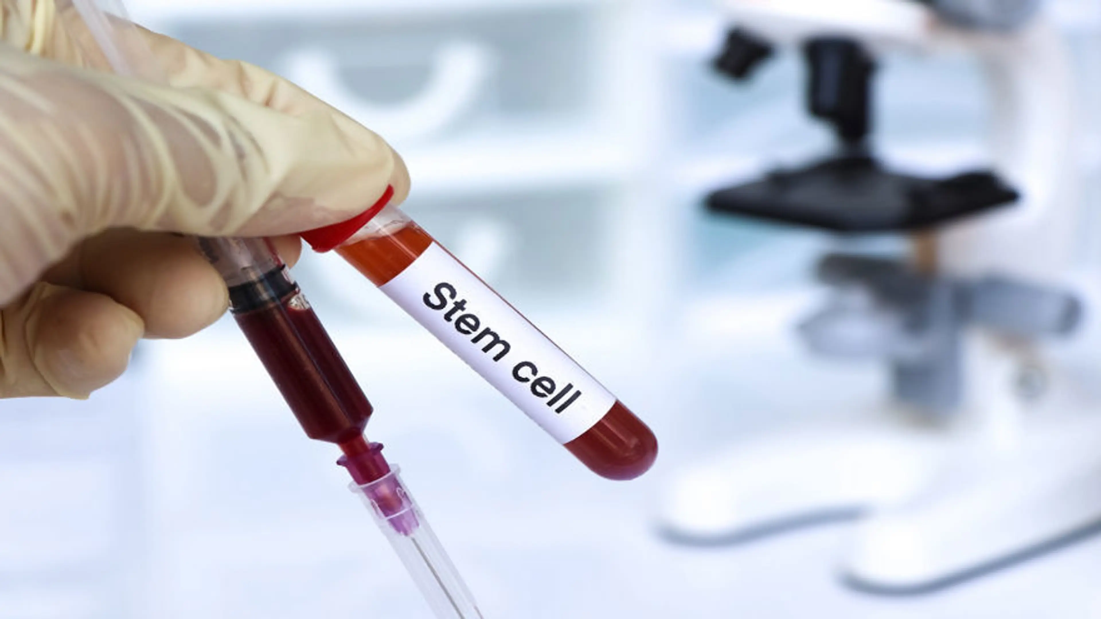 Can Stem Cells Reduce Recovery Time After Major Surgery?