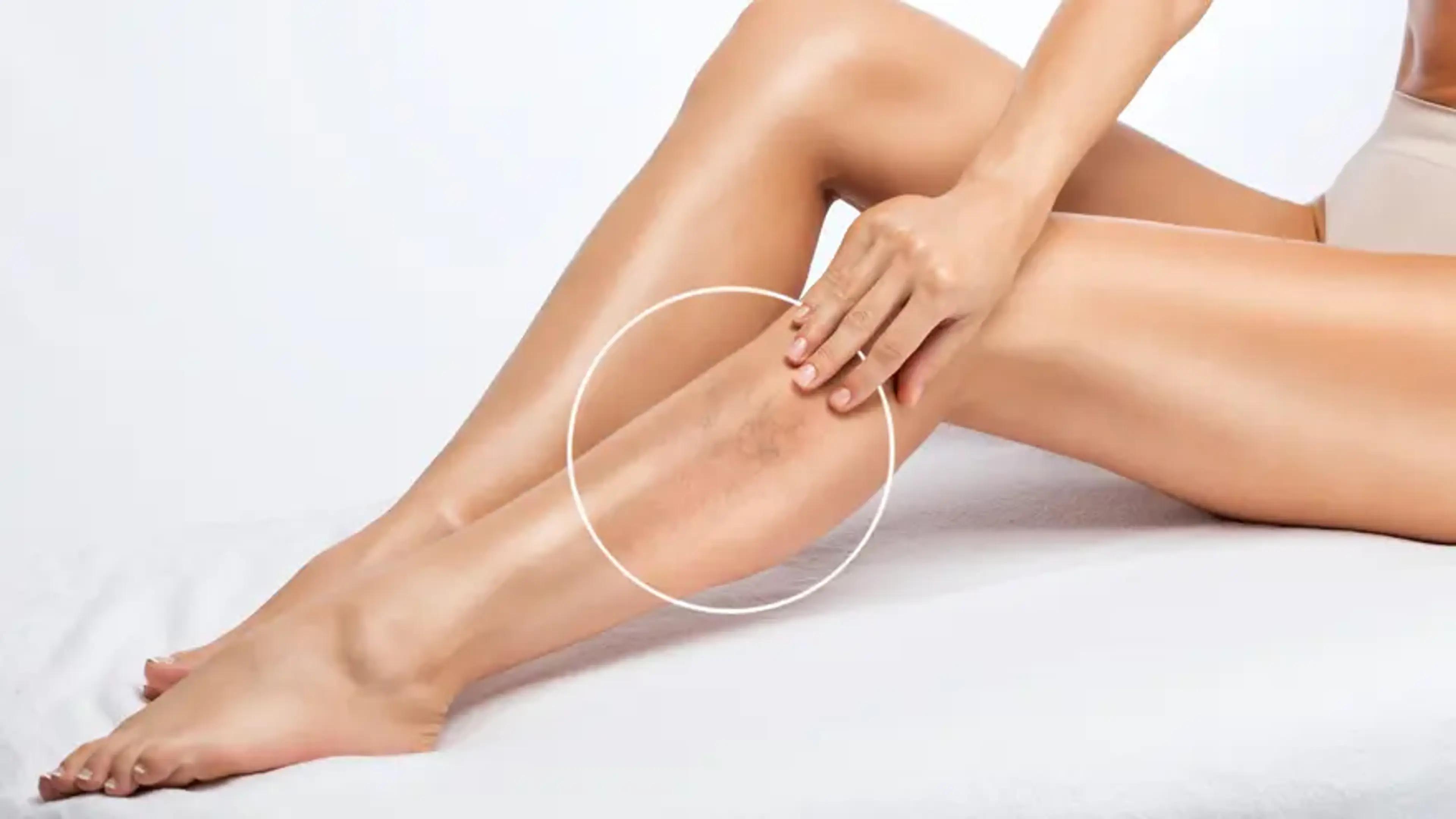 Non-Surgical Treatment Of Varicose