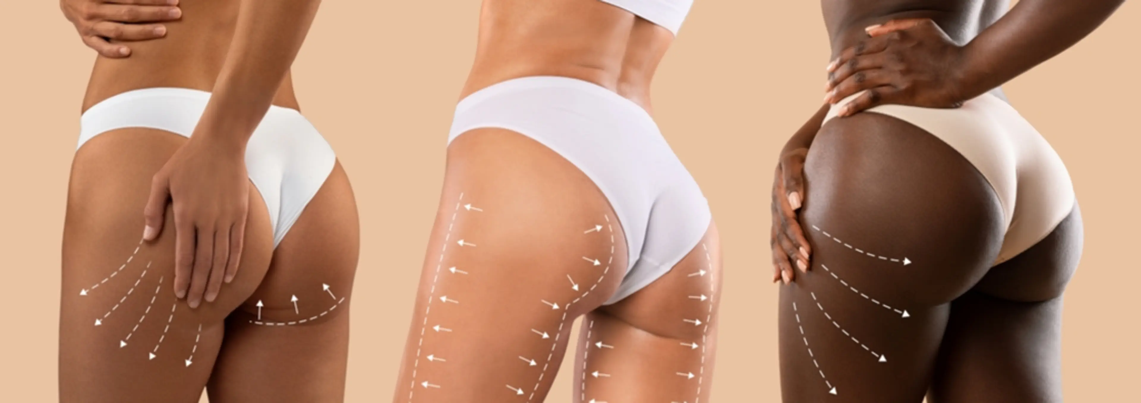 Dite Plastic Surgery