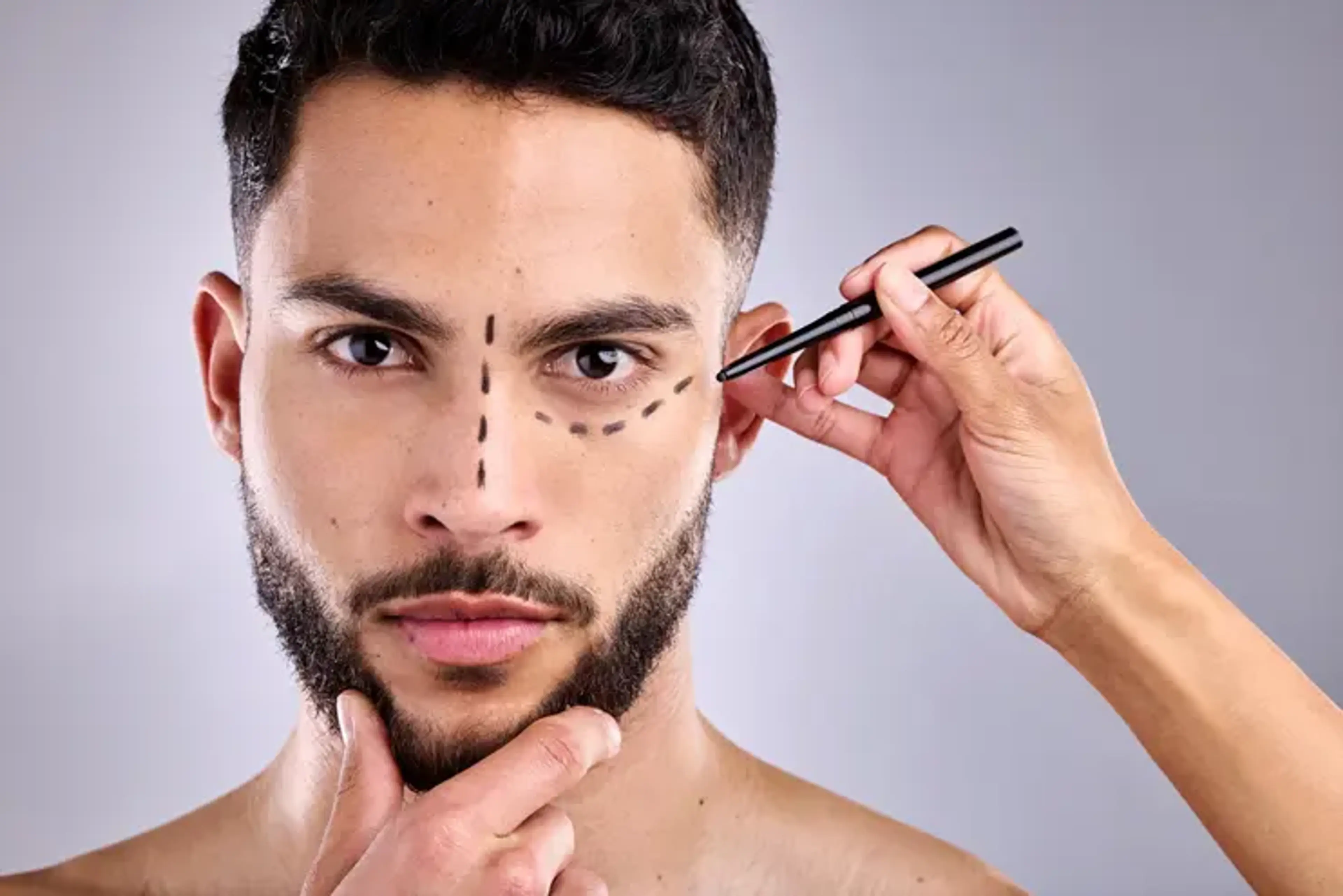 Male Rhinoplasty