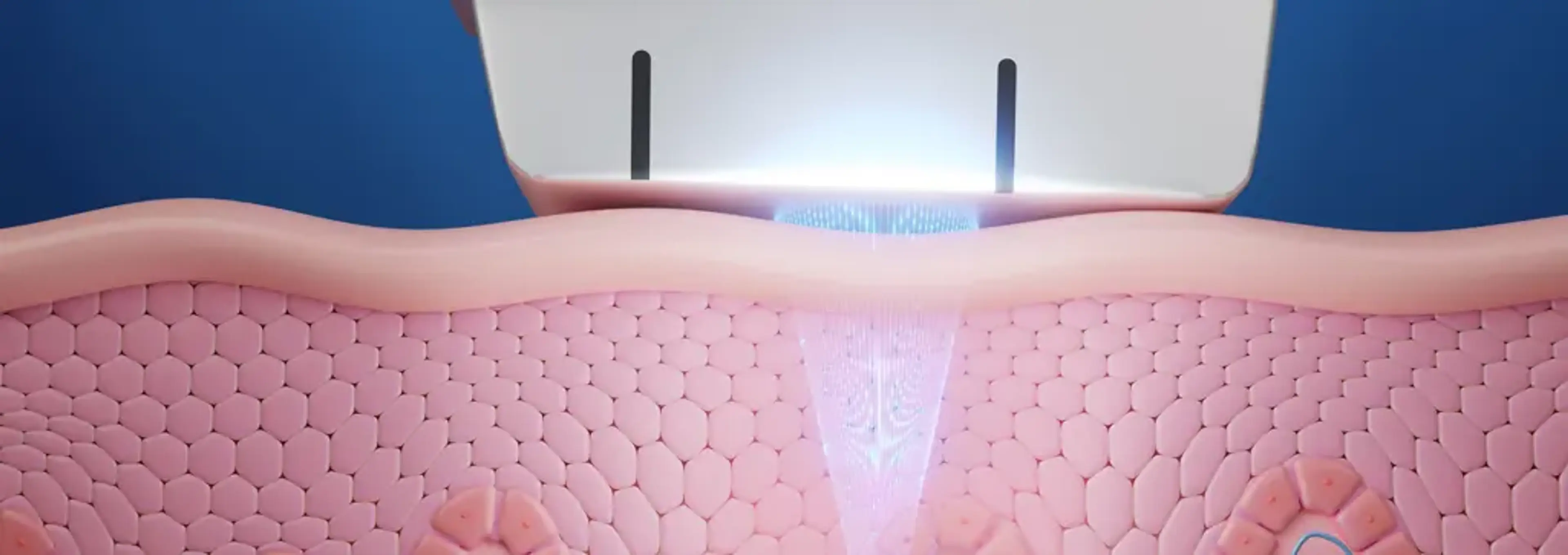 1mm Plastic Surgery