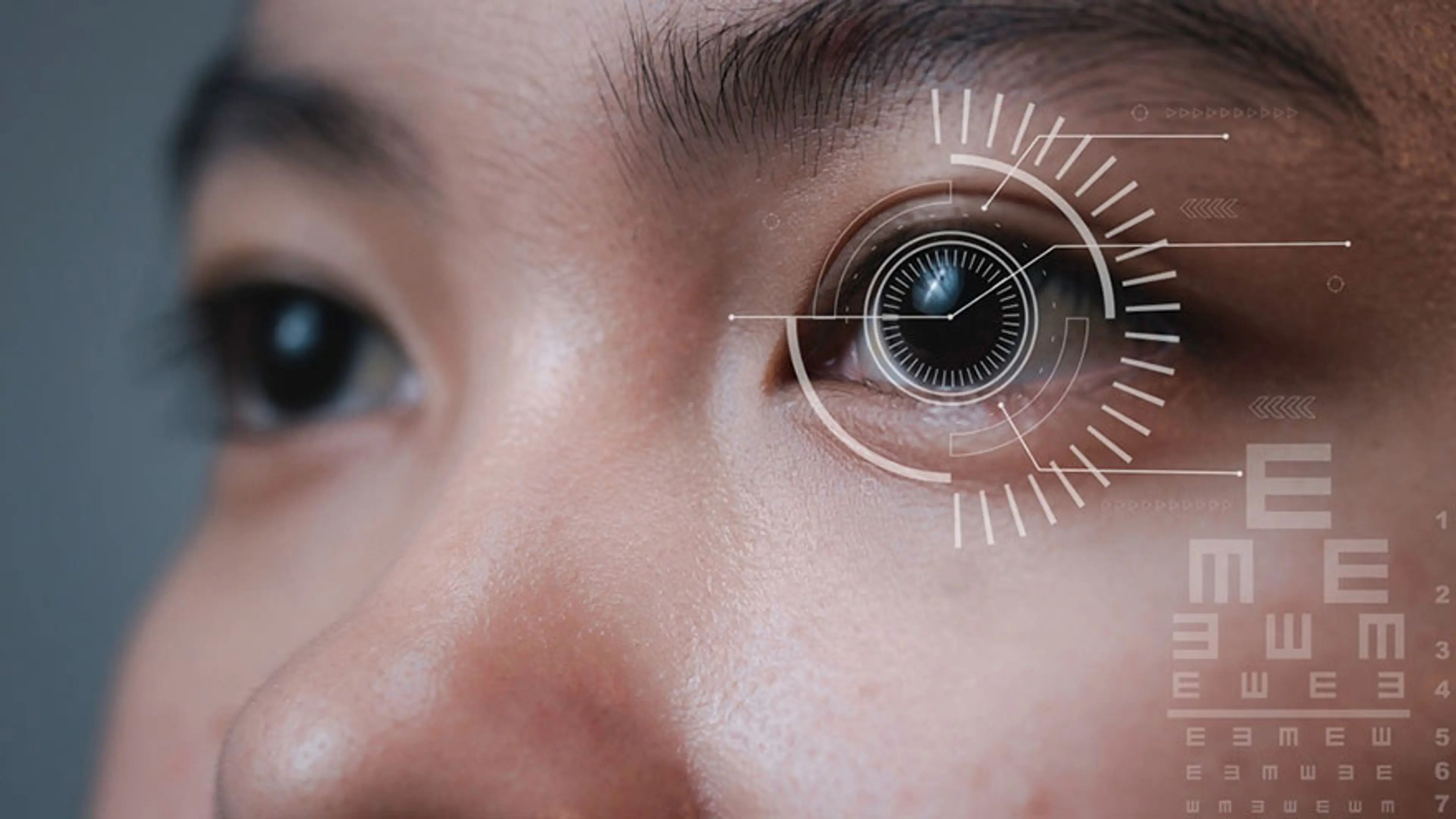 Operasi Koreksi Penglihatan