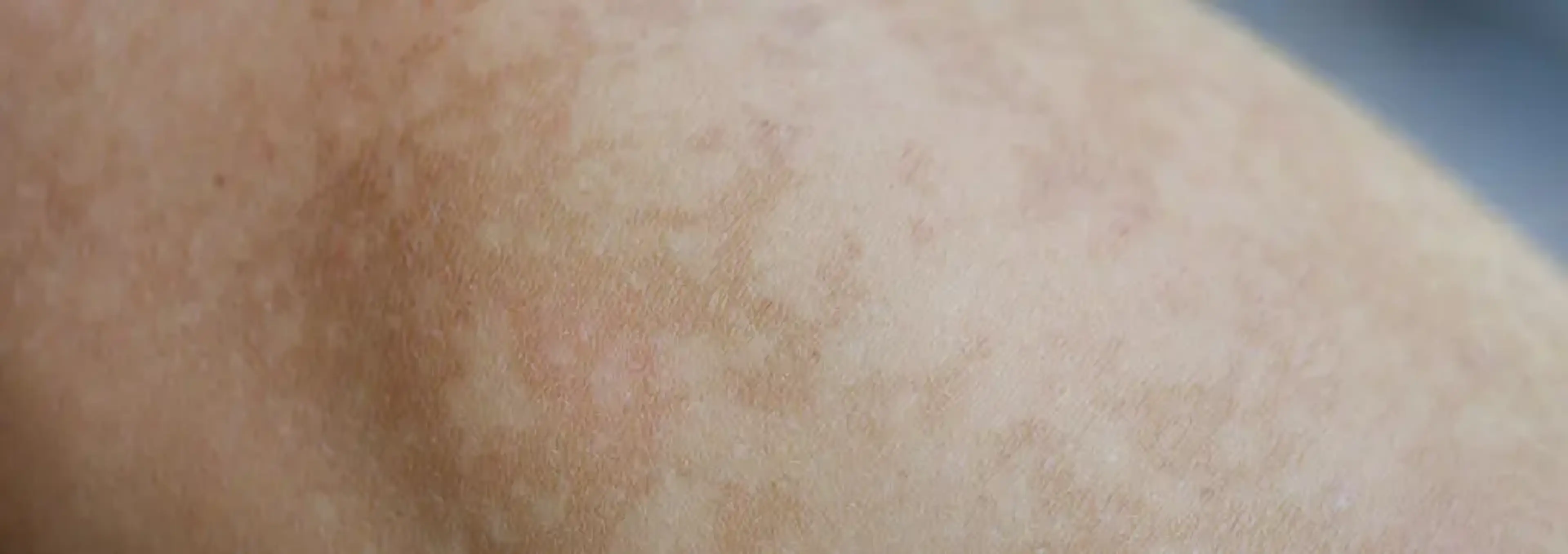 Delight Dermatology Clinic