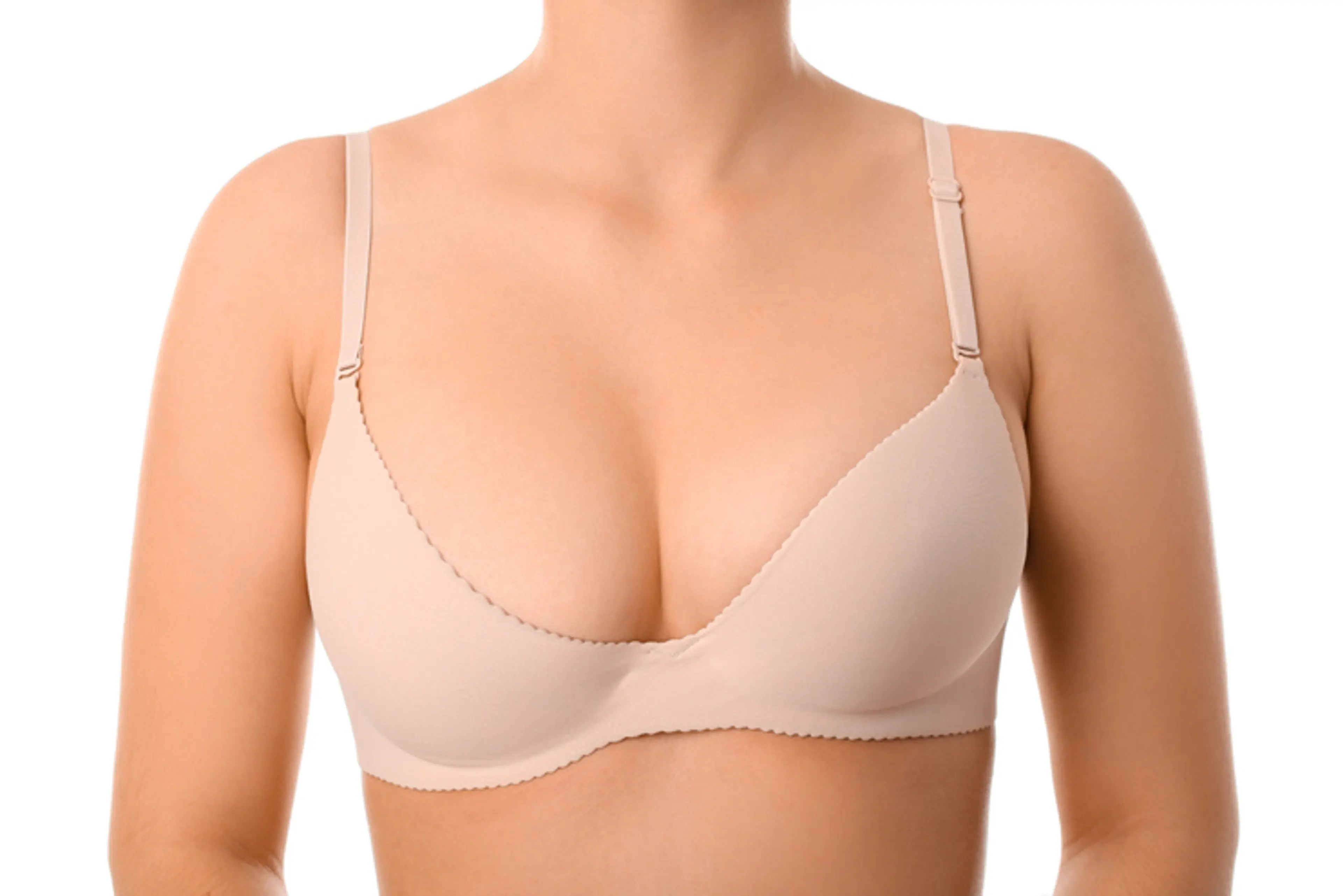 Breast asymmetry