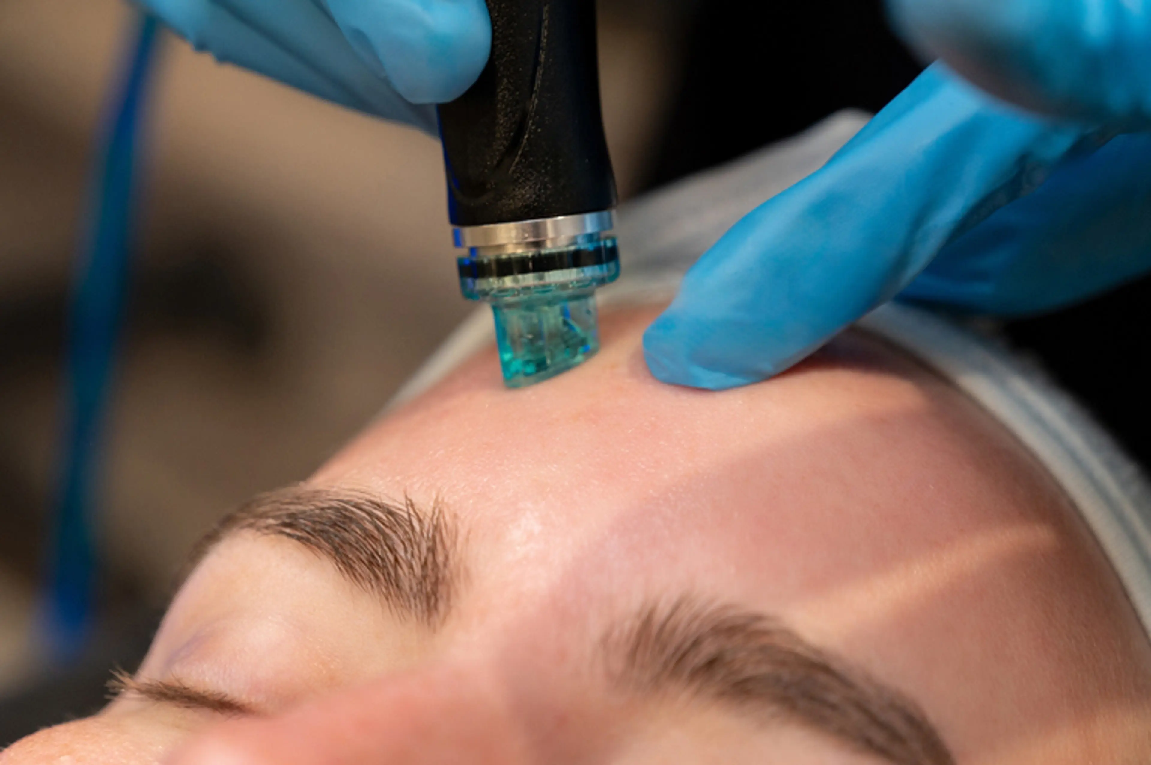 Non-Surgical