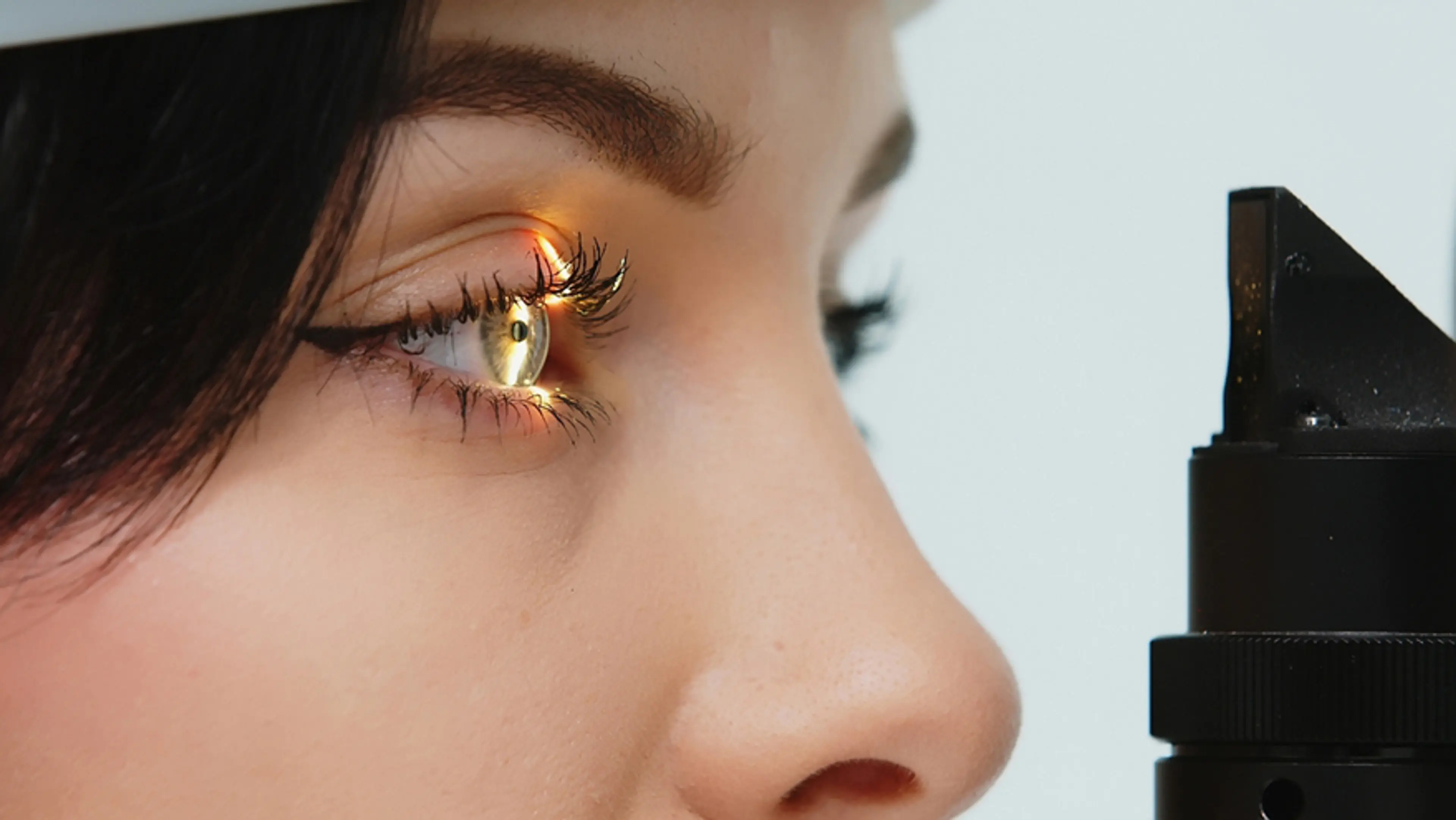Managing Glaucoma