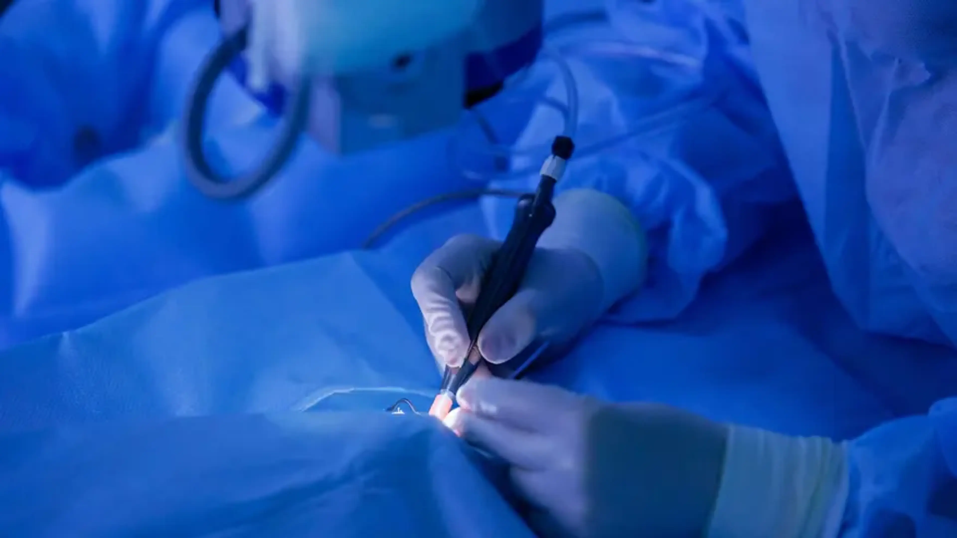 LASIK Cost