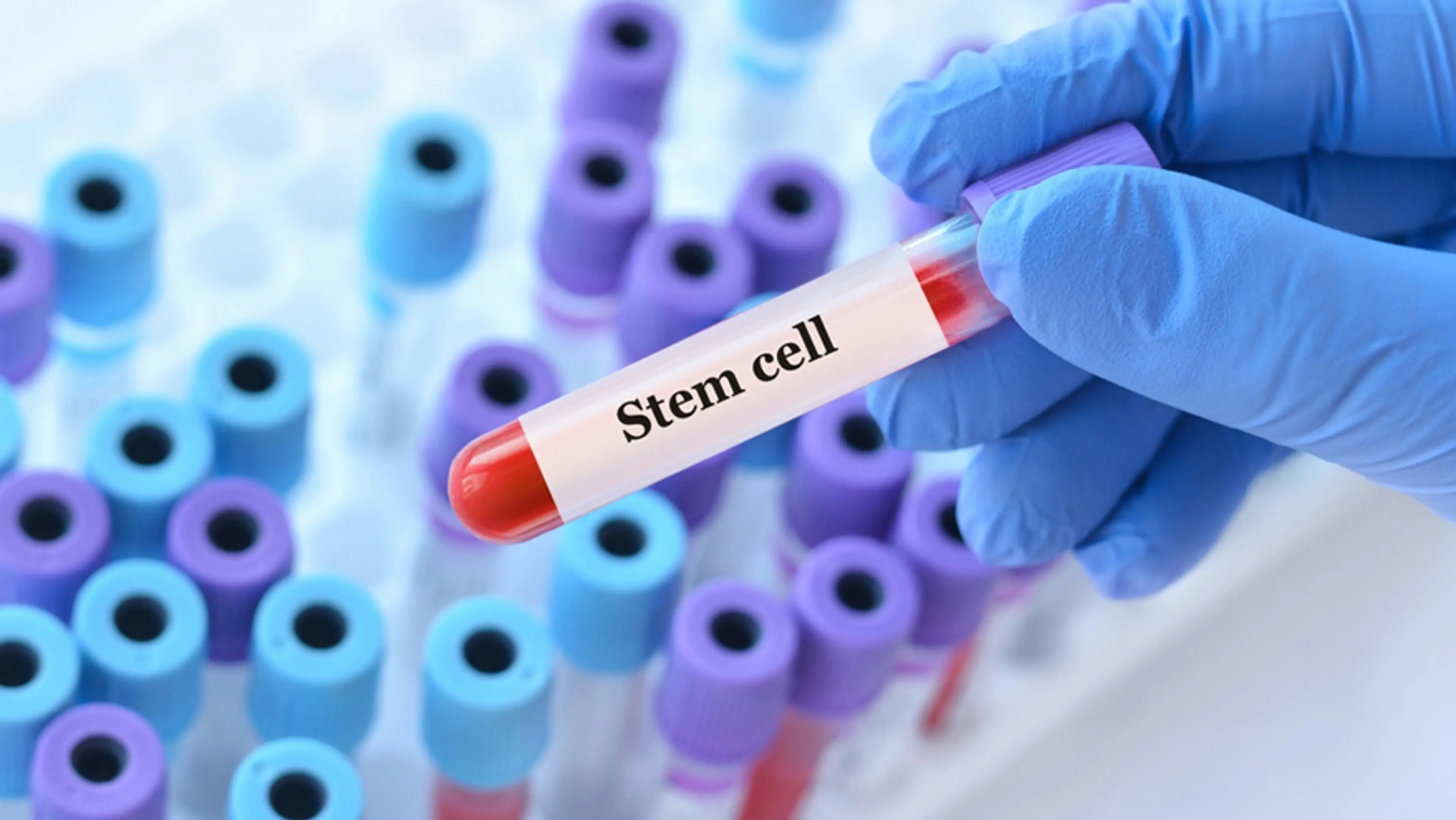 How Stem Cells Help Your Body Stay Ahead of Chronic Disease Development