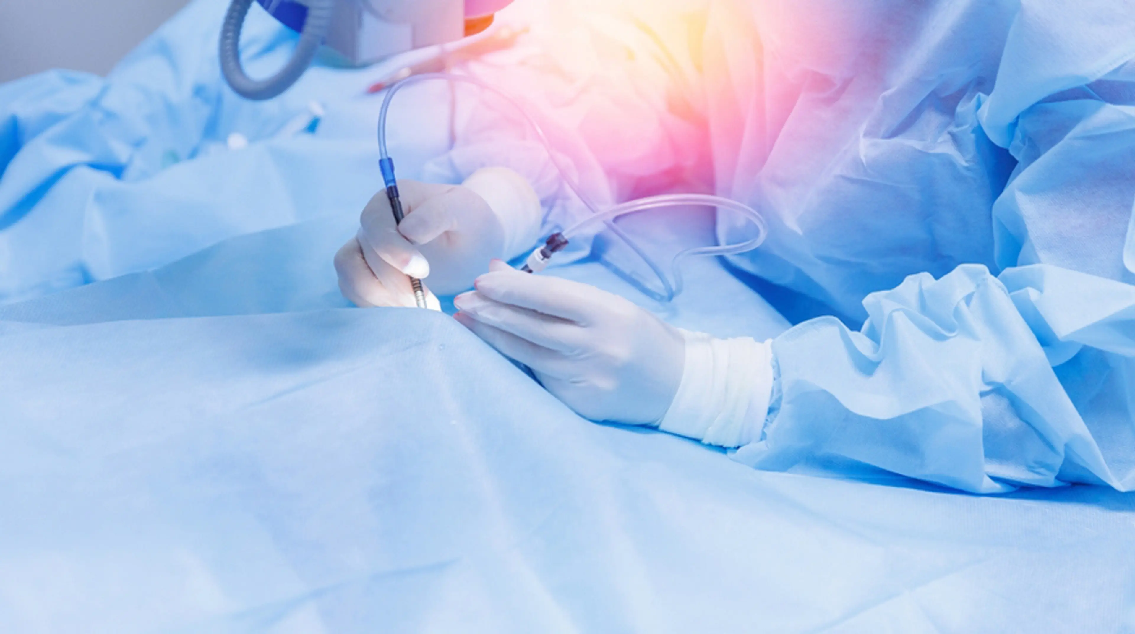 Laser-Assisted Cataract Surgery