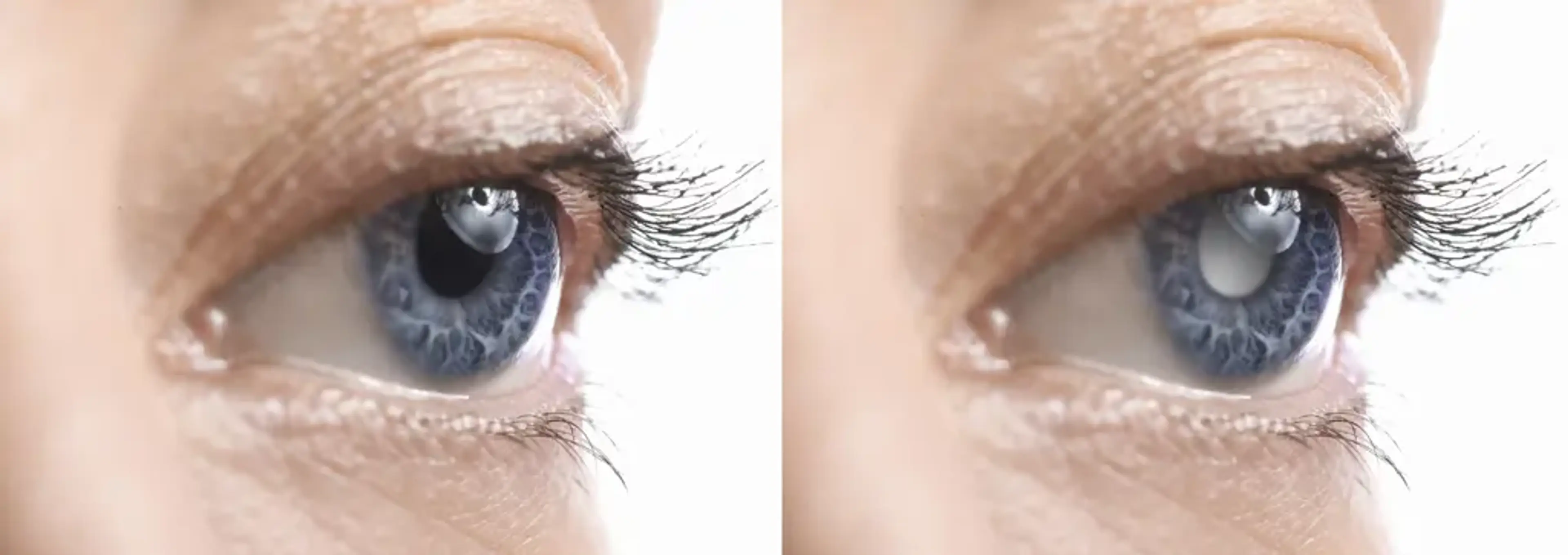 Gangnam Joeunnun Vision Clinic