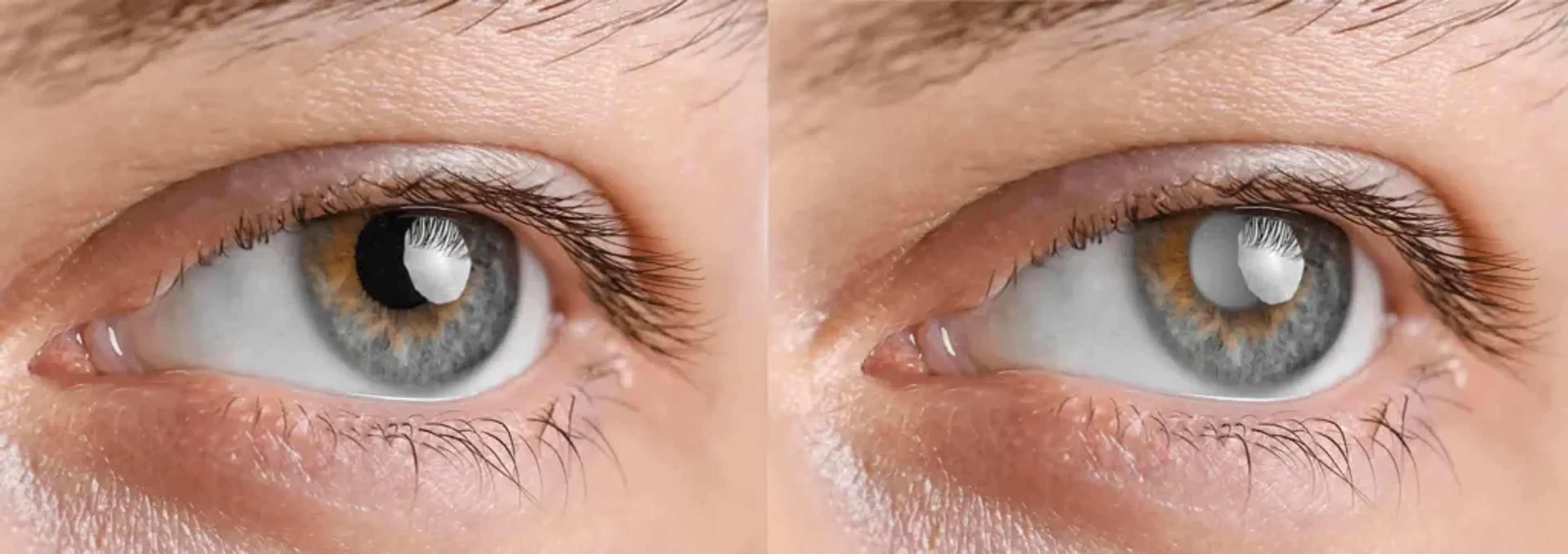 SNU Eye Clinic