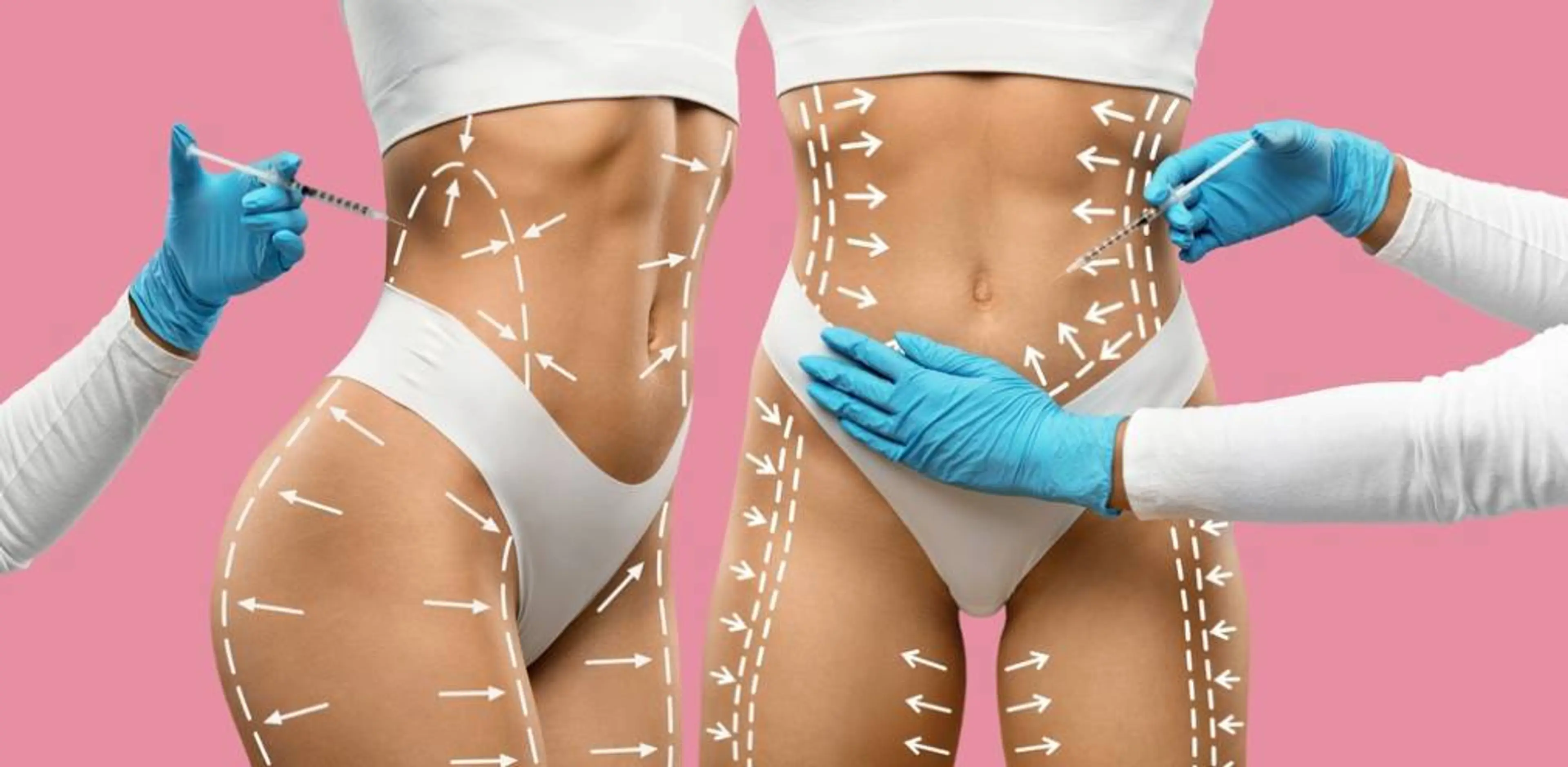 Body Contouring Injections