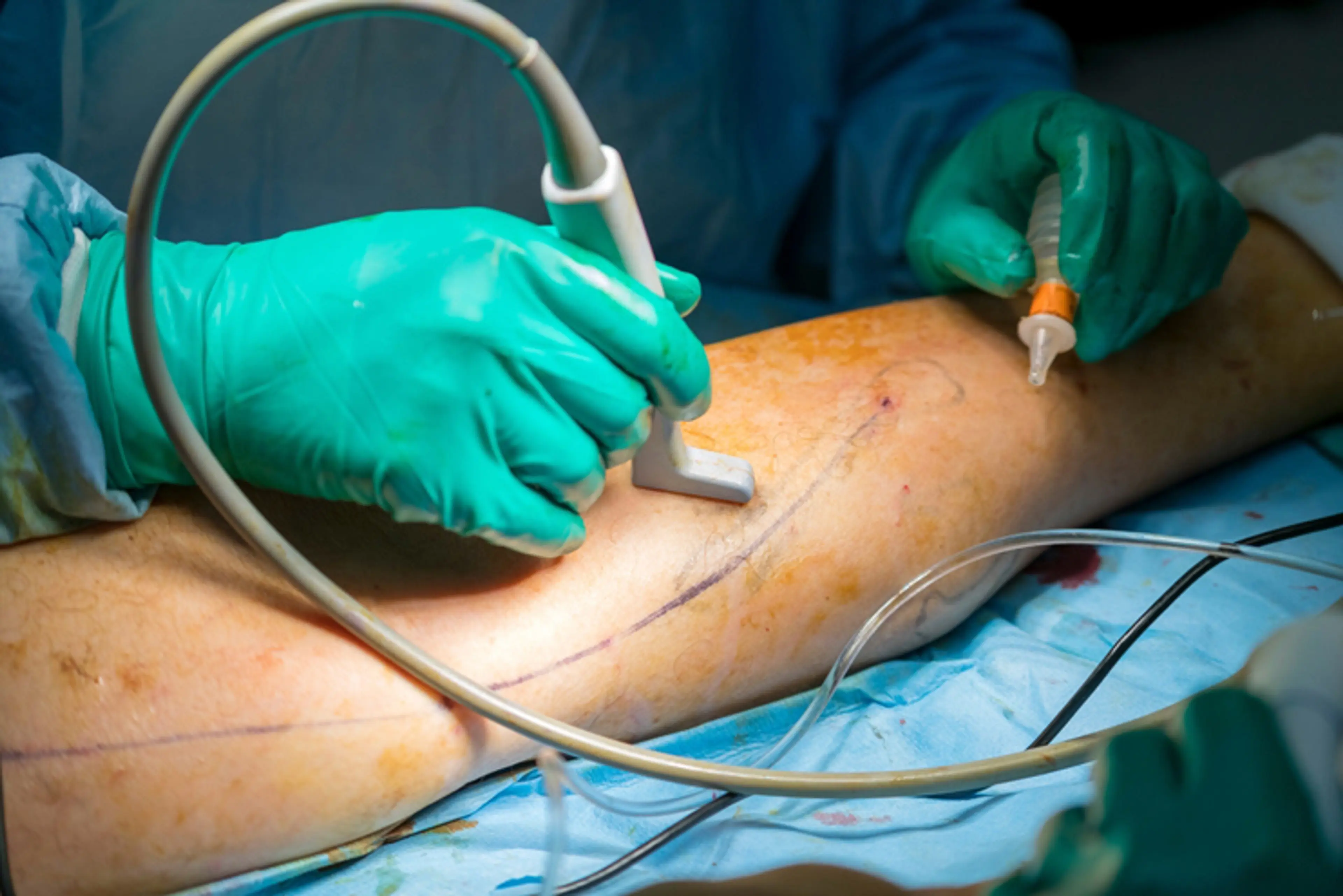 Vascular Surgery.