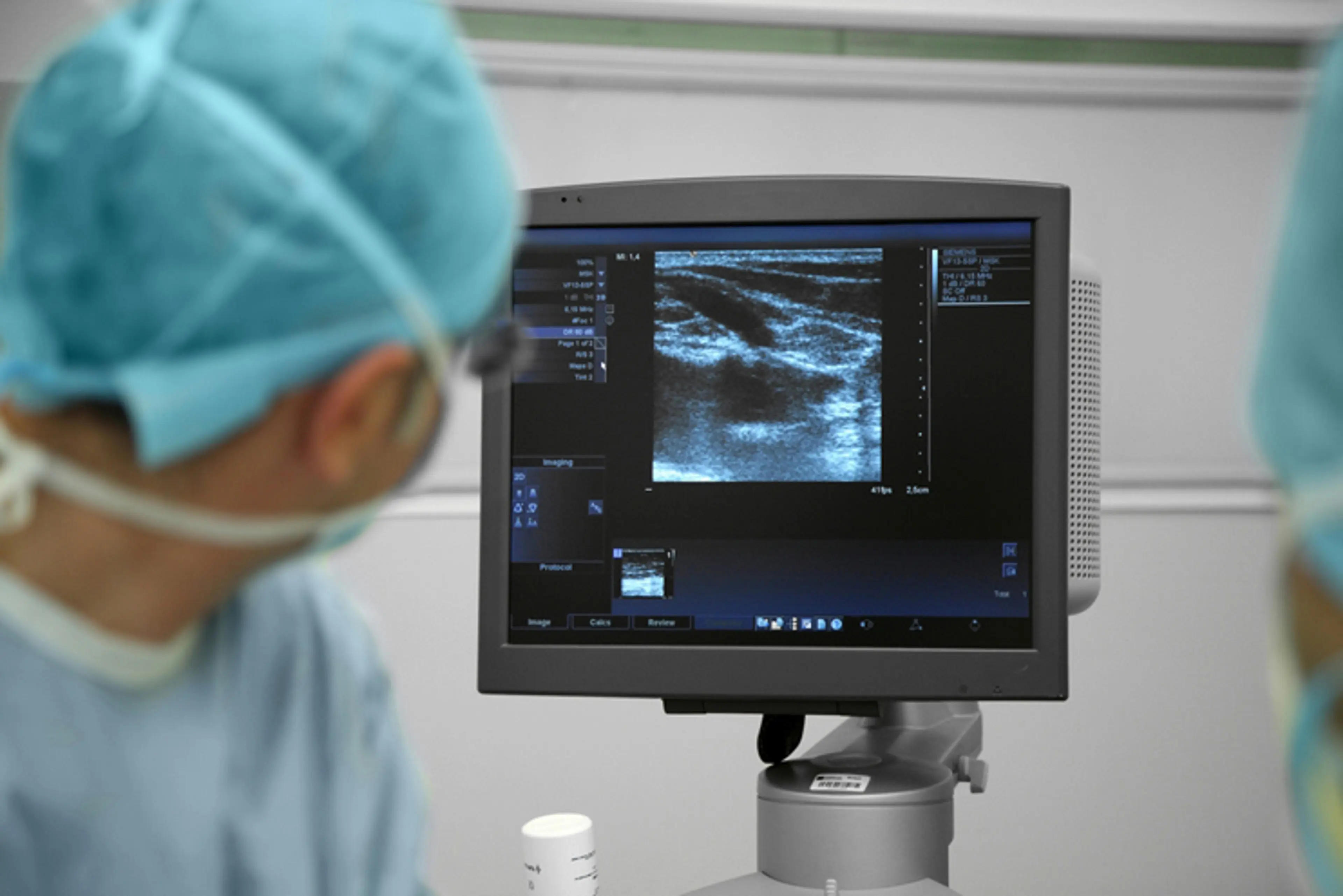 超声引导下硬化治疗