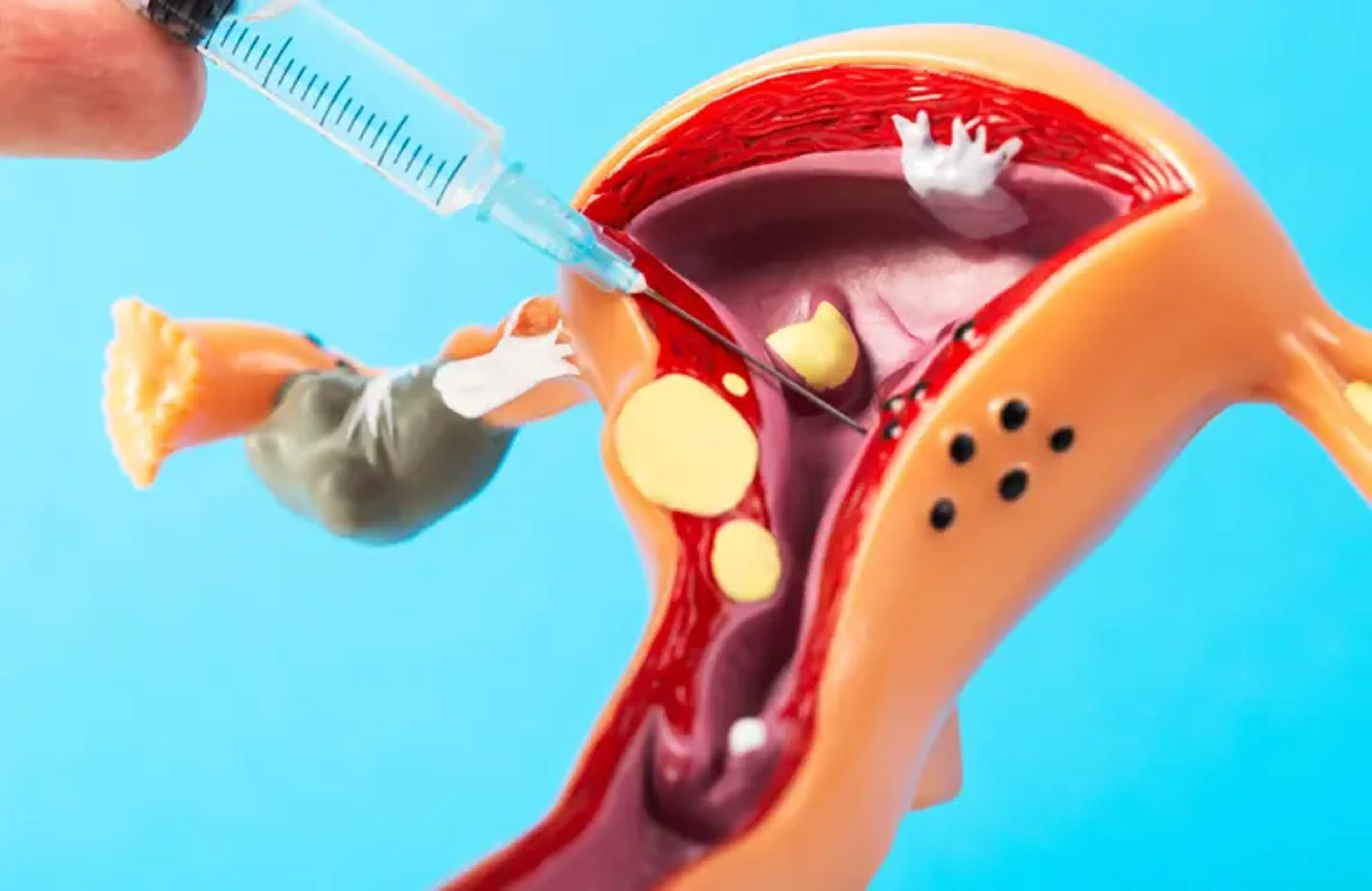 Clitoral Pop Filler