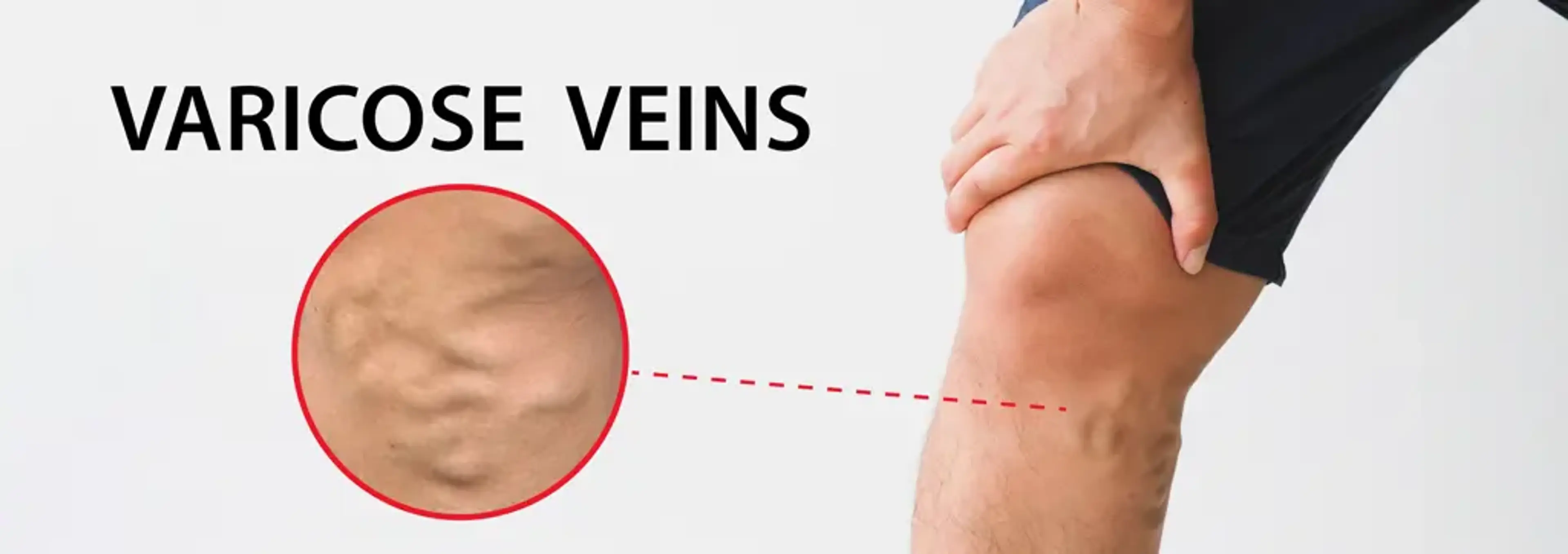 Charm Vascular Clinic