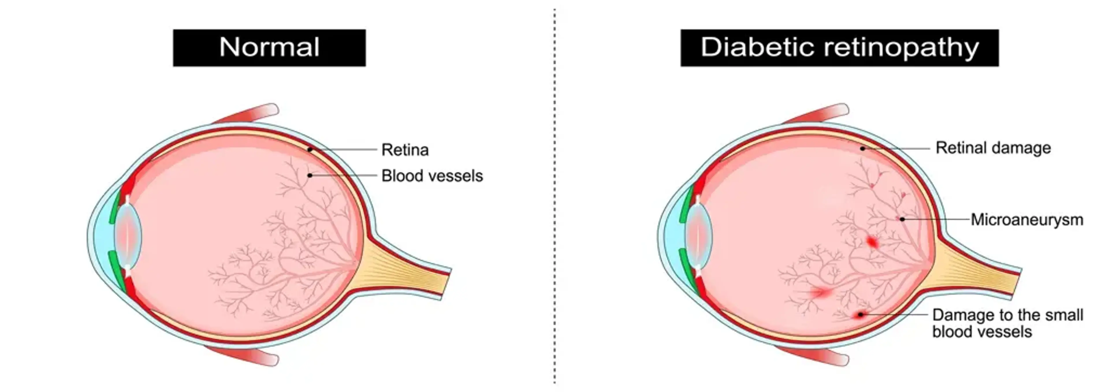 Dekabi Stem Cell Clinic