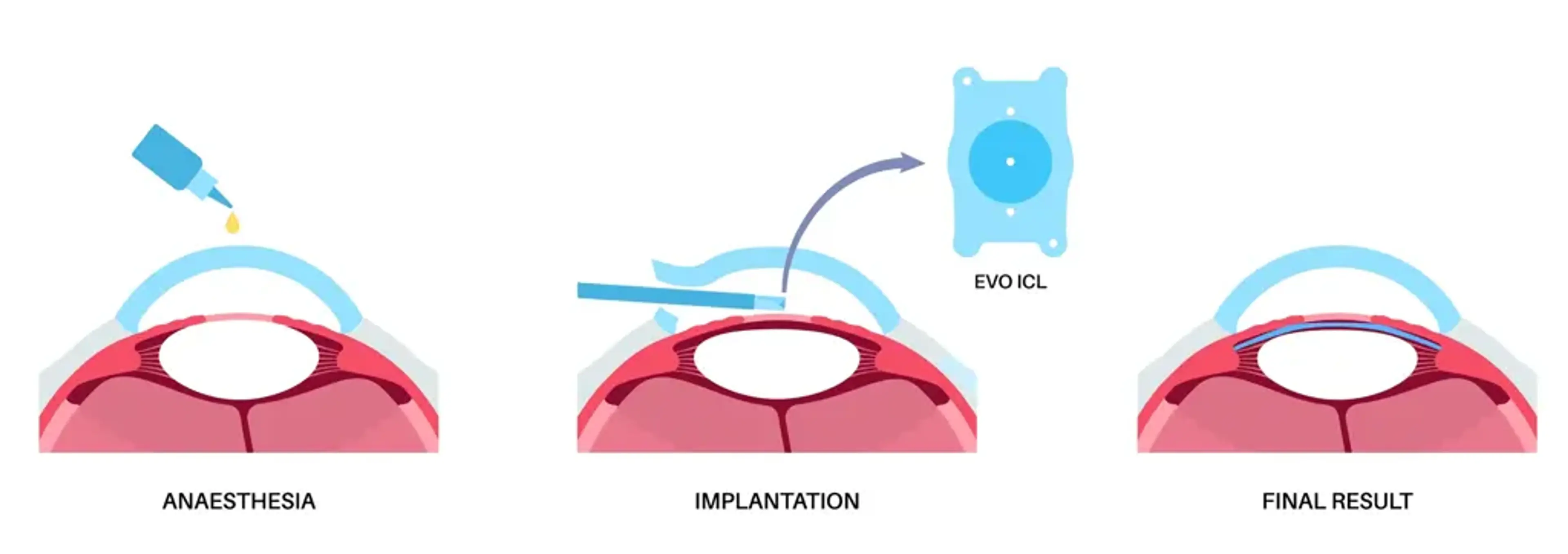 Gangnam Joeunnun Vision Clinic
