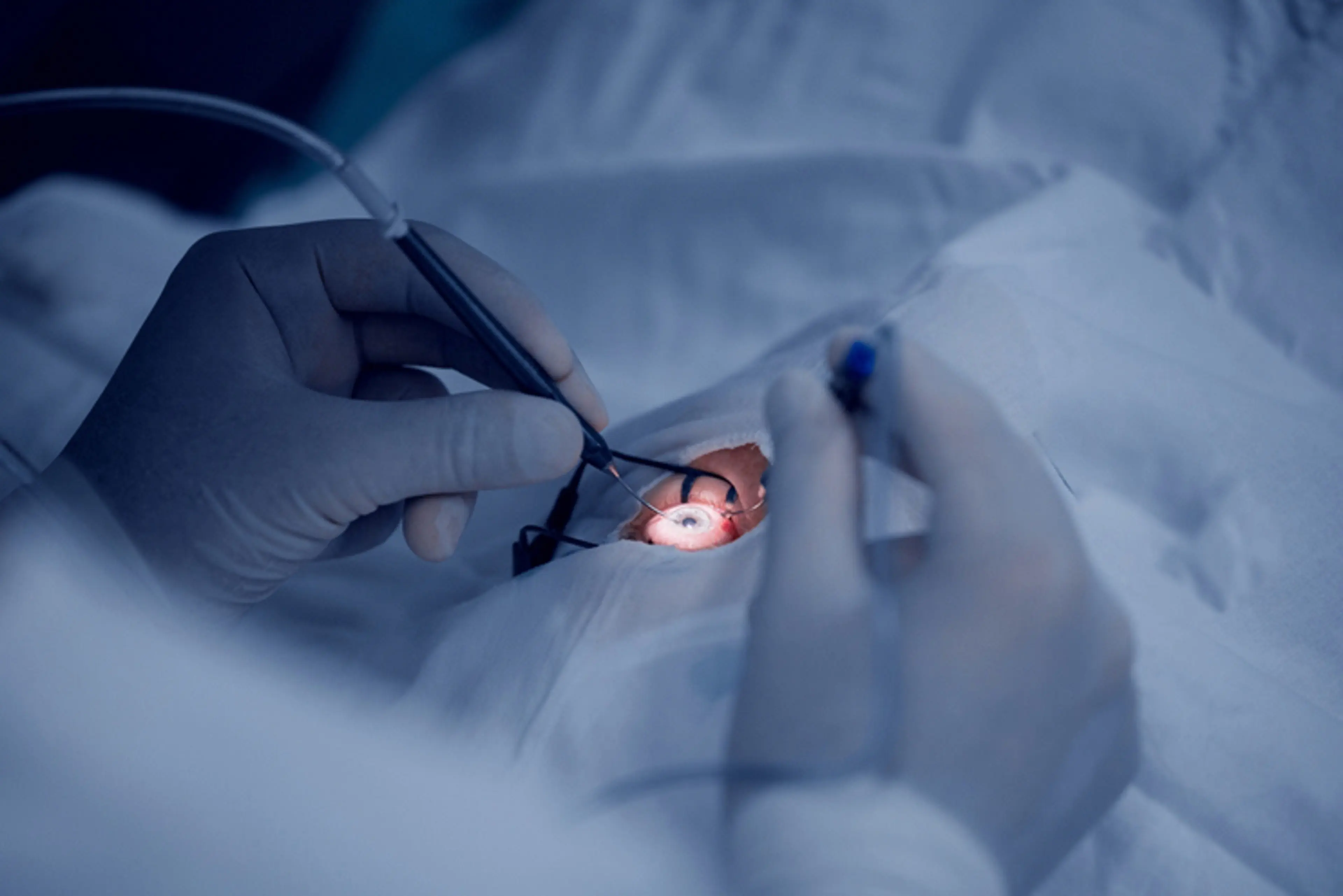 Ophthalmic surgeon performing advanced eye surgery under a microscope, illustrating precision vision correction and modern eye care technology.  Select 75 more words to run Humanizer.