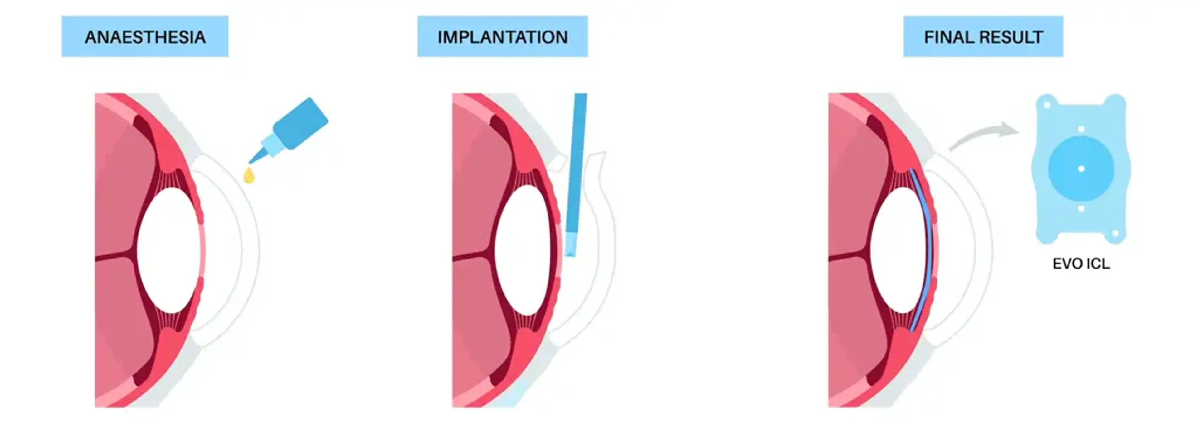 Gangnam Joeunnun Vision Clinic