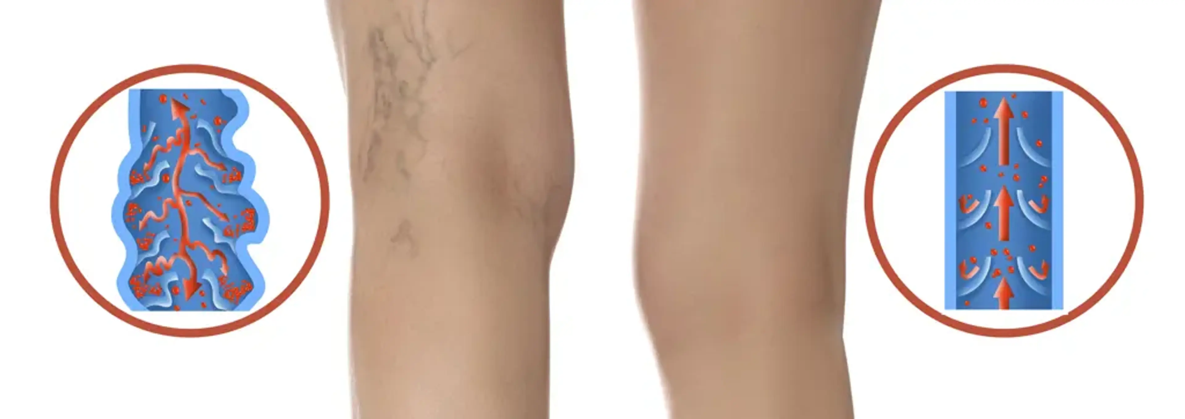 Charm Vascular Clinic