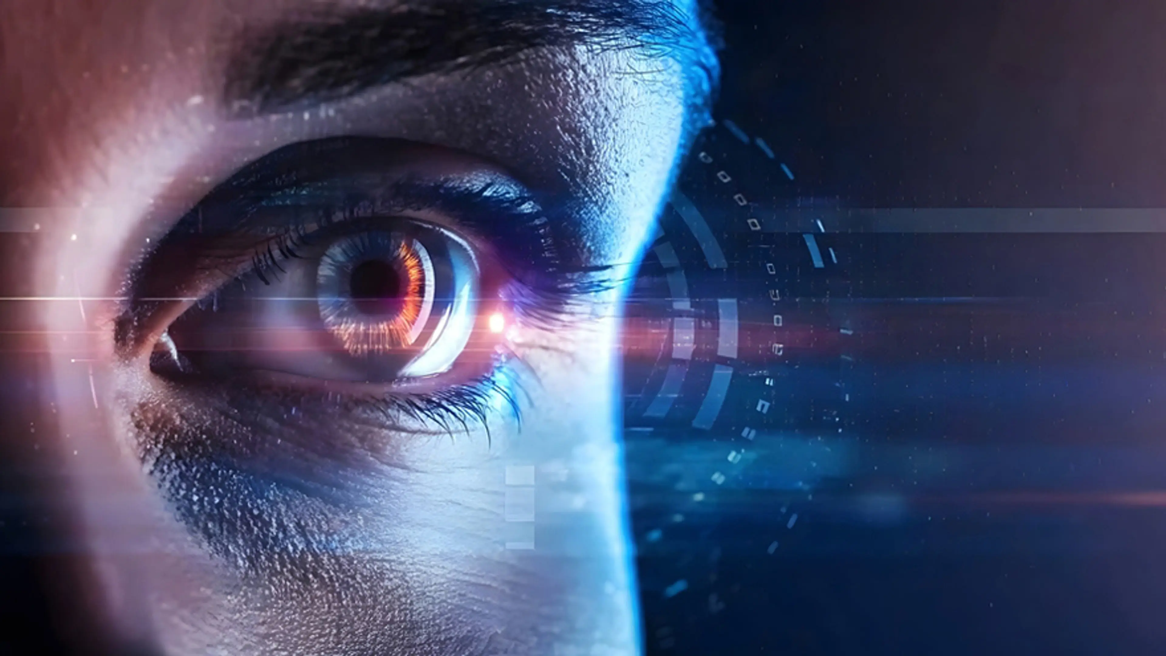 LASIK