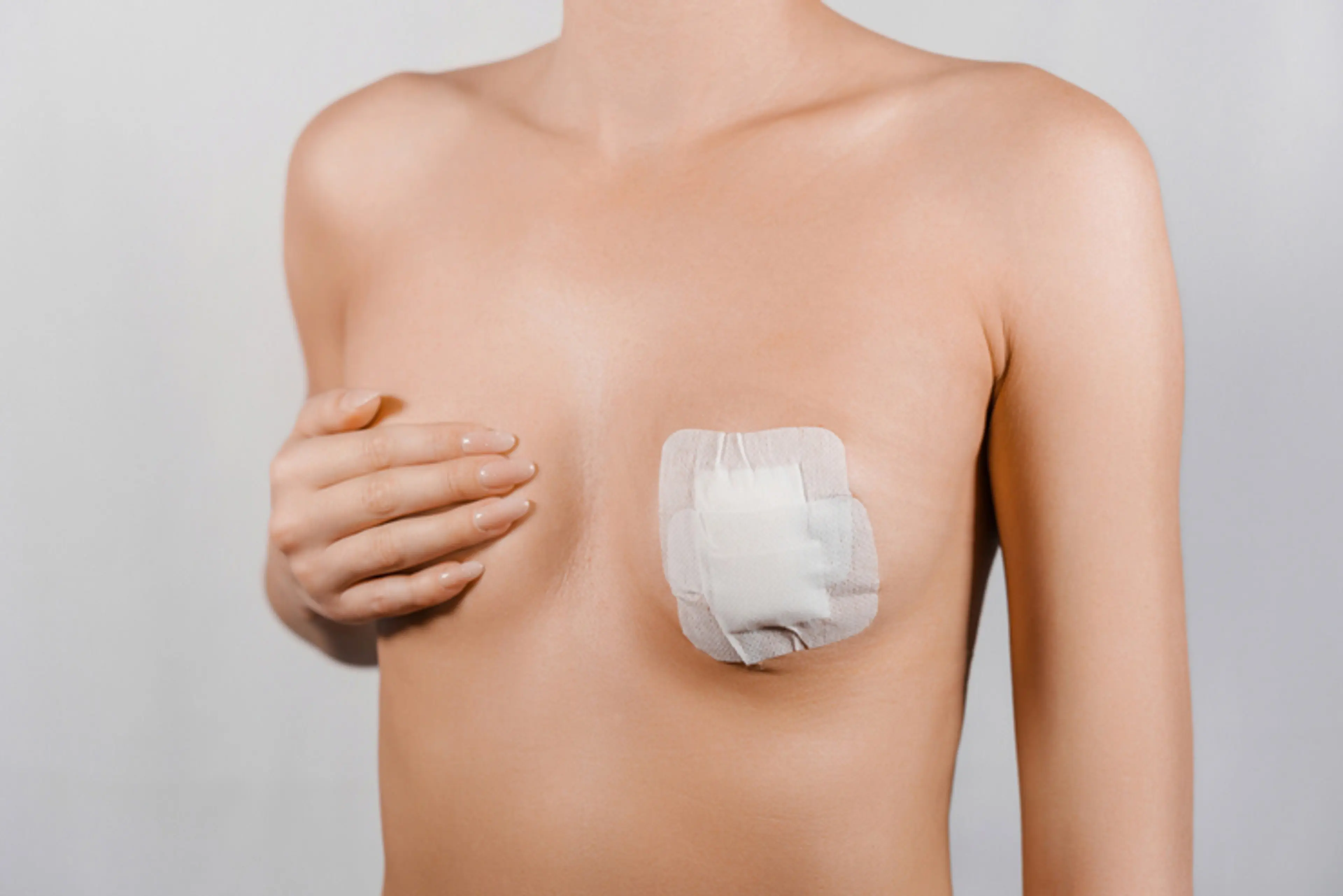 Nipple and Areola Reduction Surgery