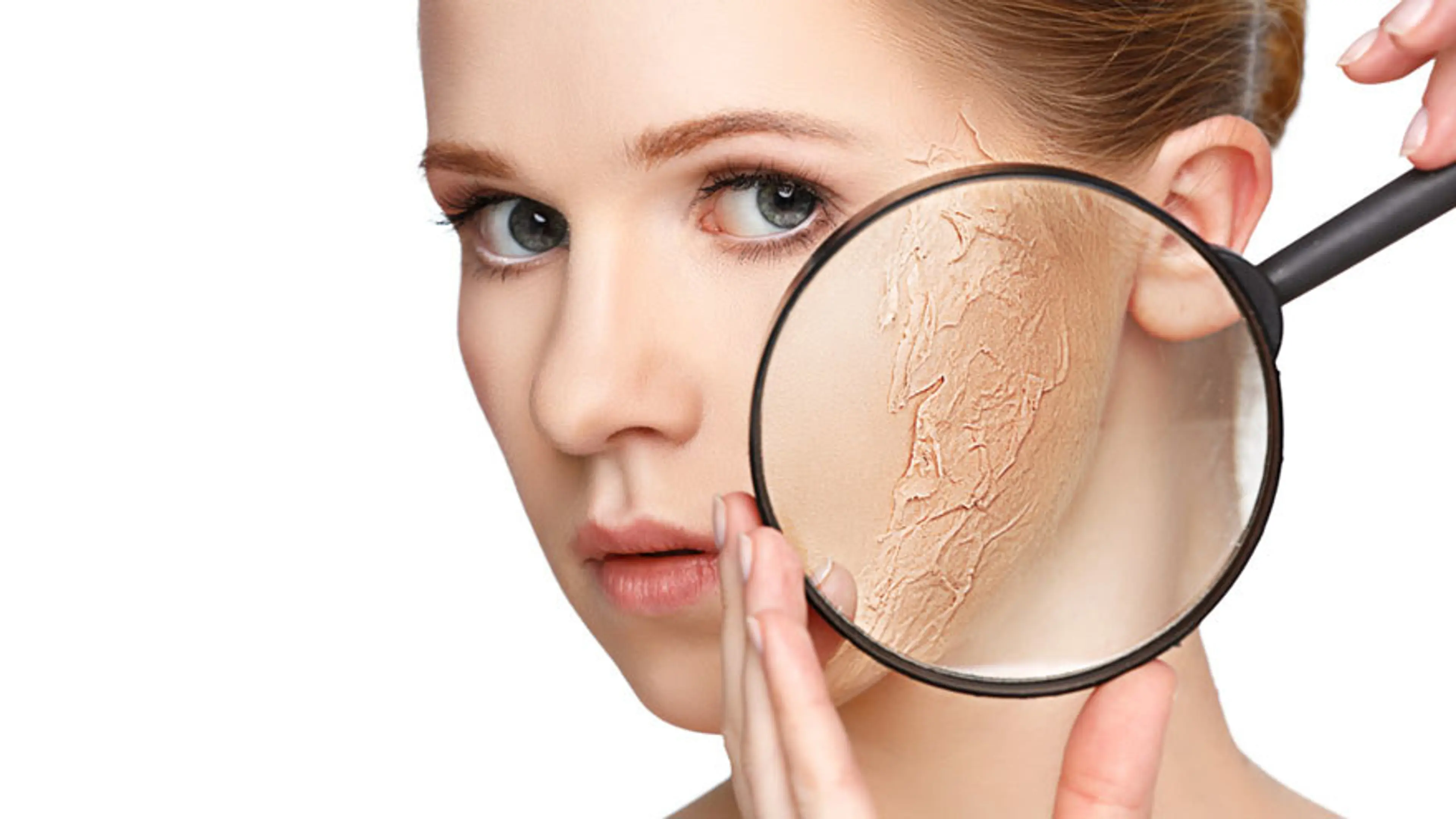Dry and Dehydrated Skin