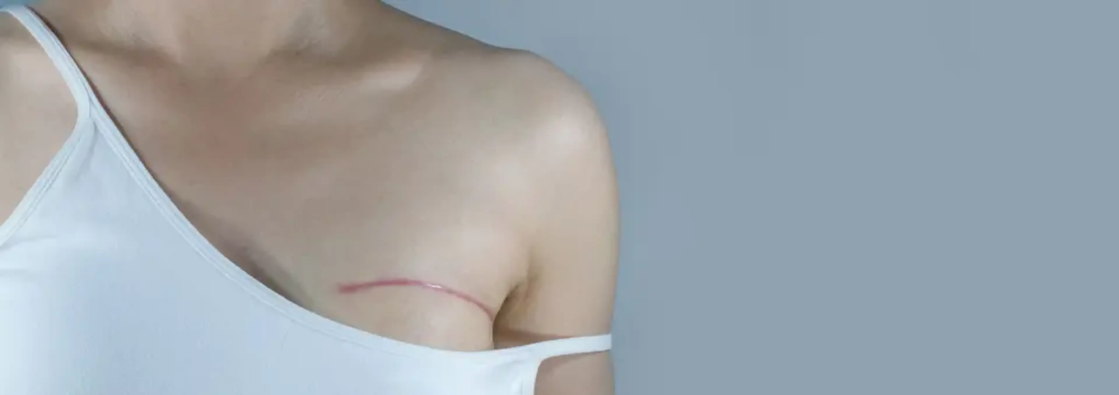 Human Plastic Surgery