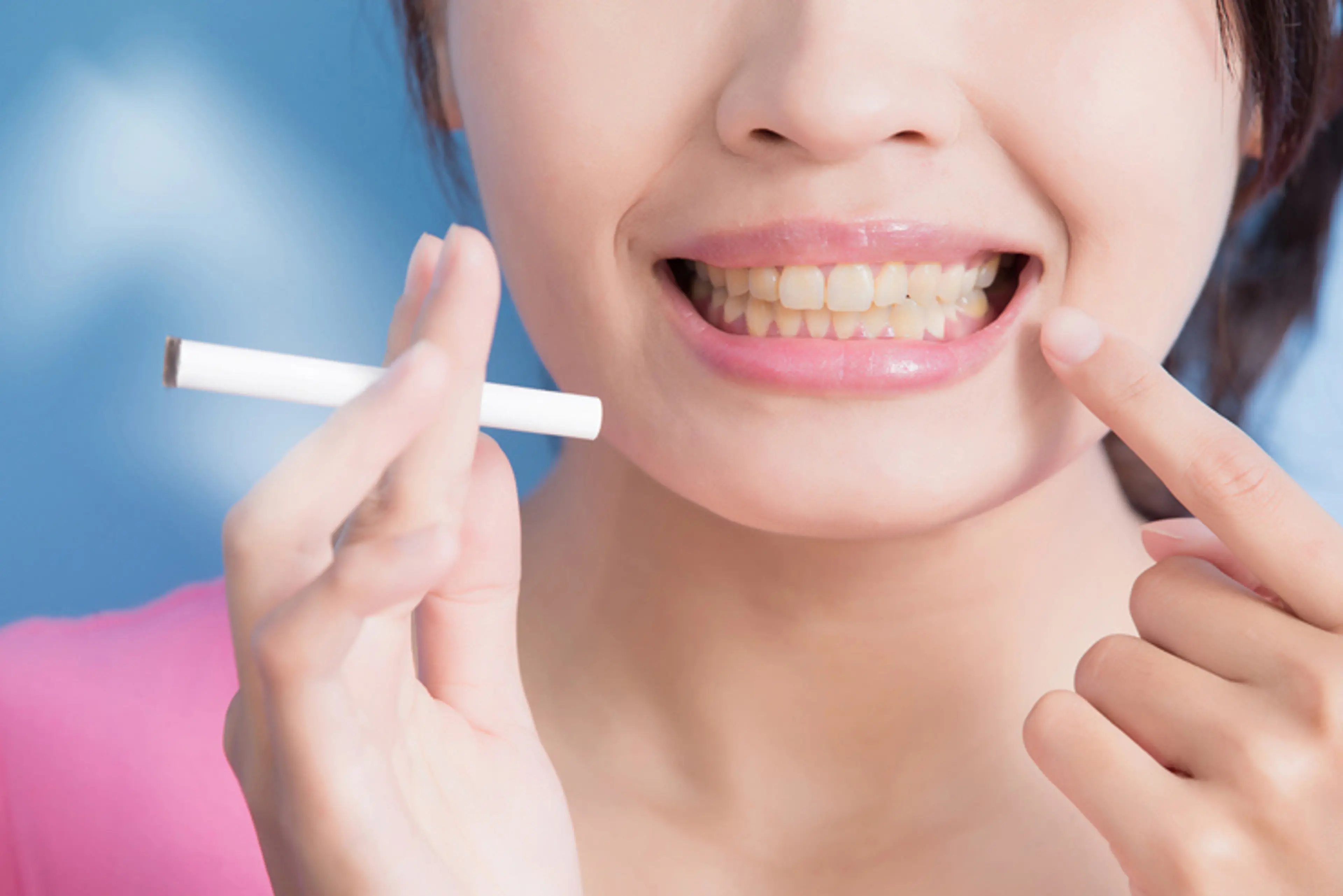 Teeth Whitening for Smokers