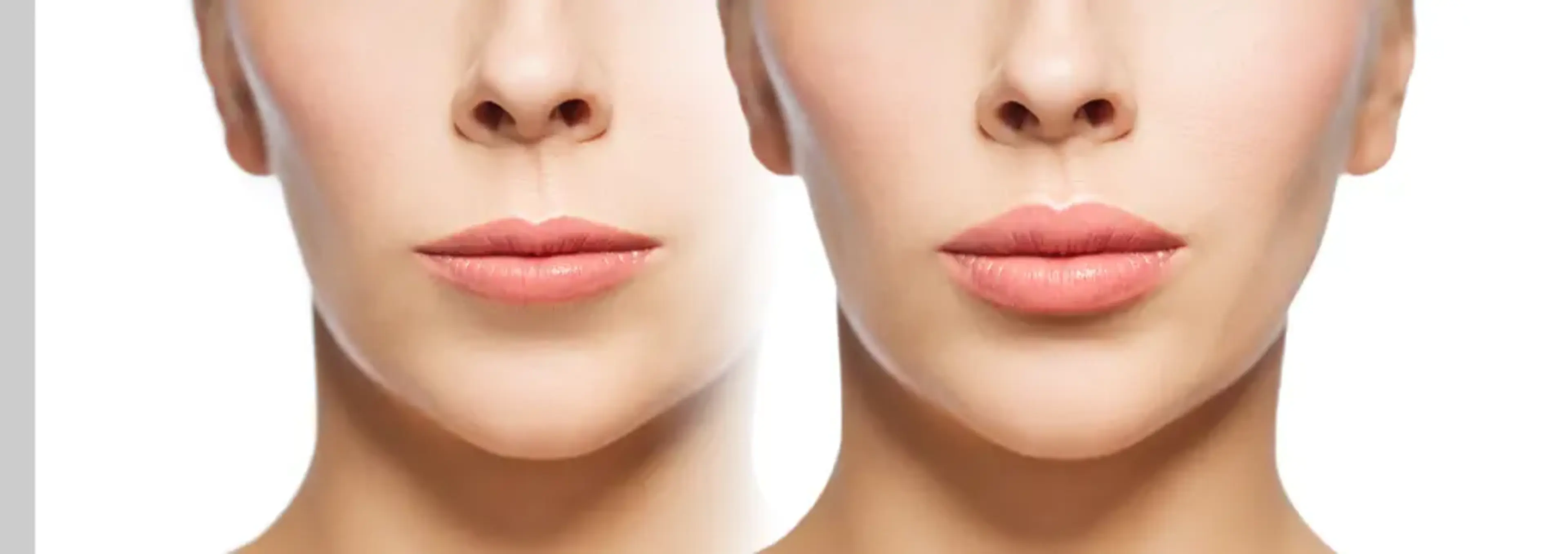 Hugo Plastic Surgery