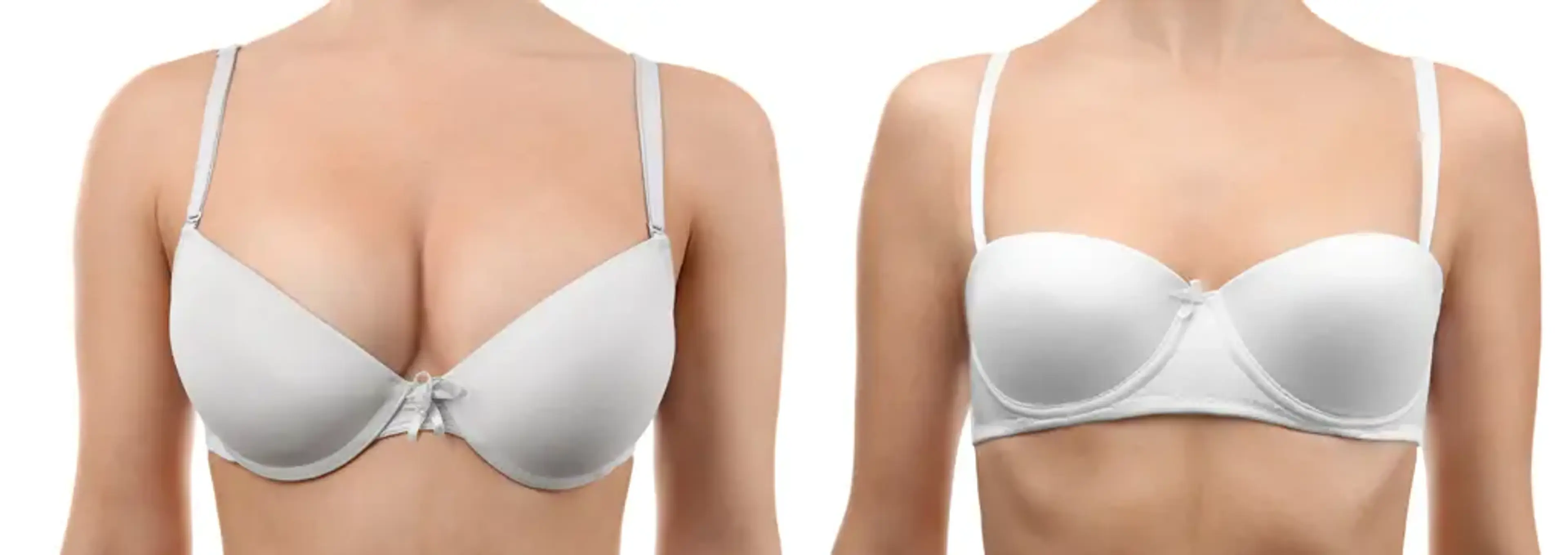 Human Plastic Surgery