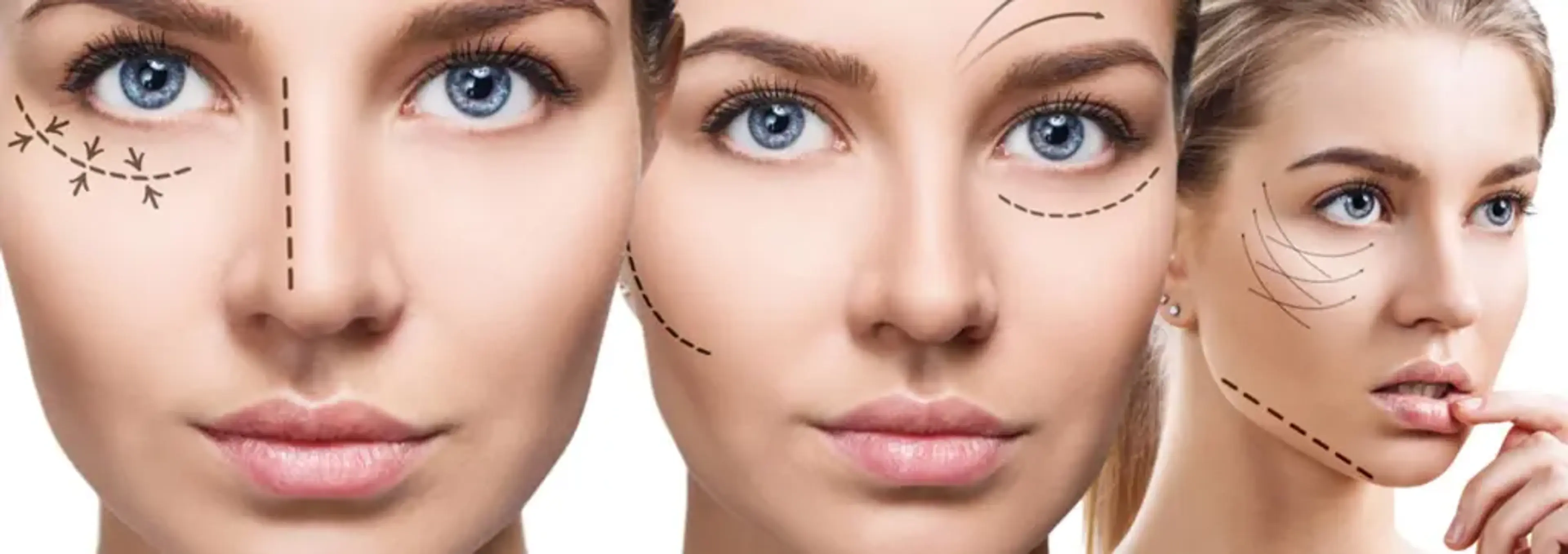 Soon Plus Plastic Surgery