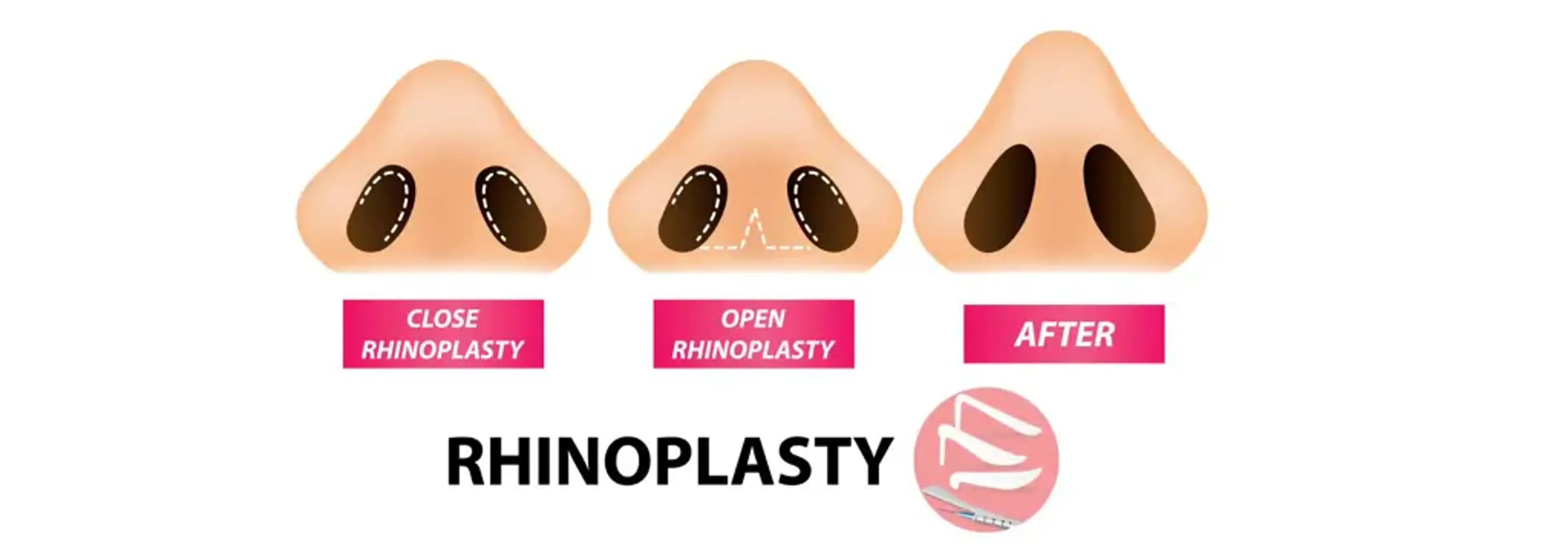 Kowon Plastic Surgery