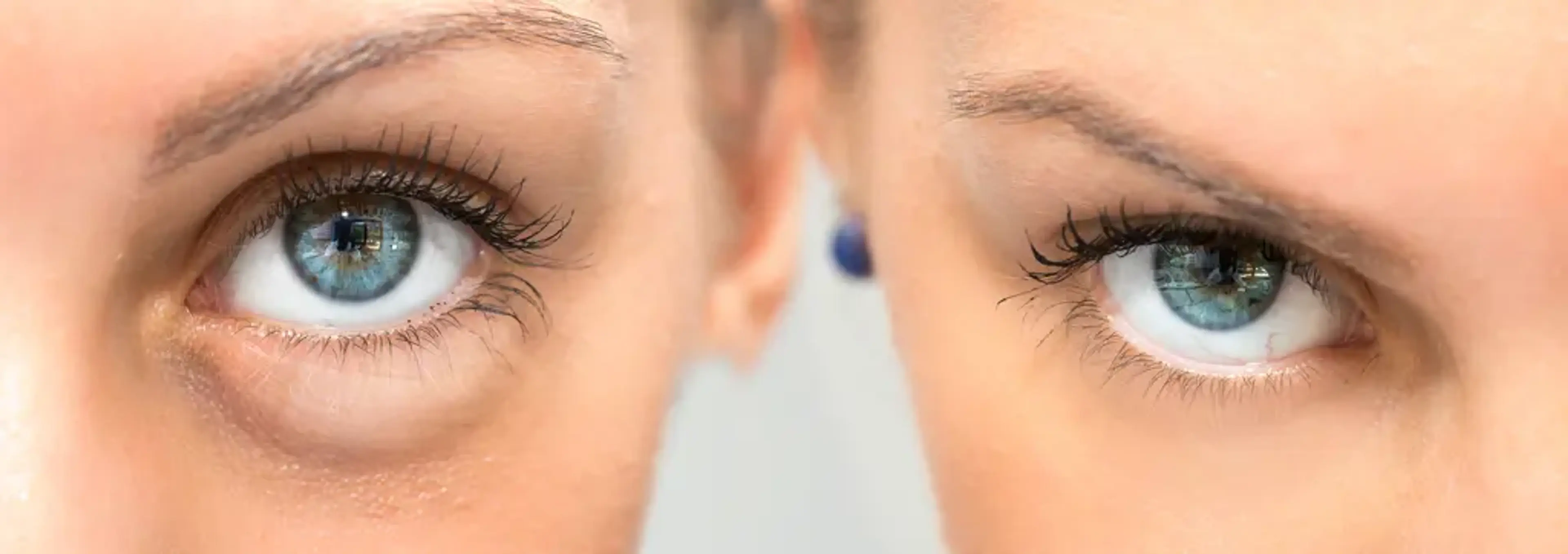 Soon Plus Plastic Surgery