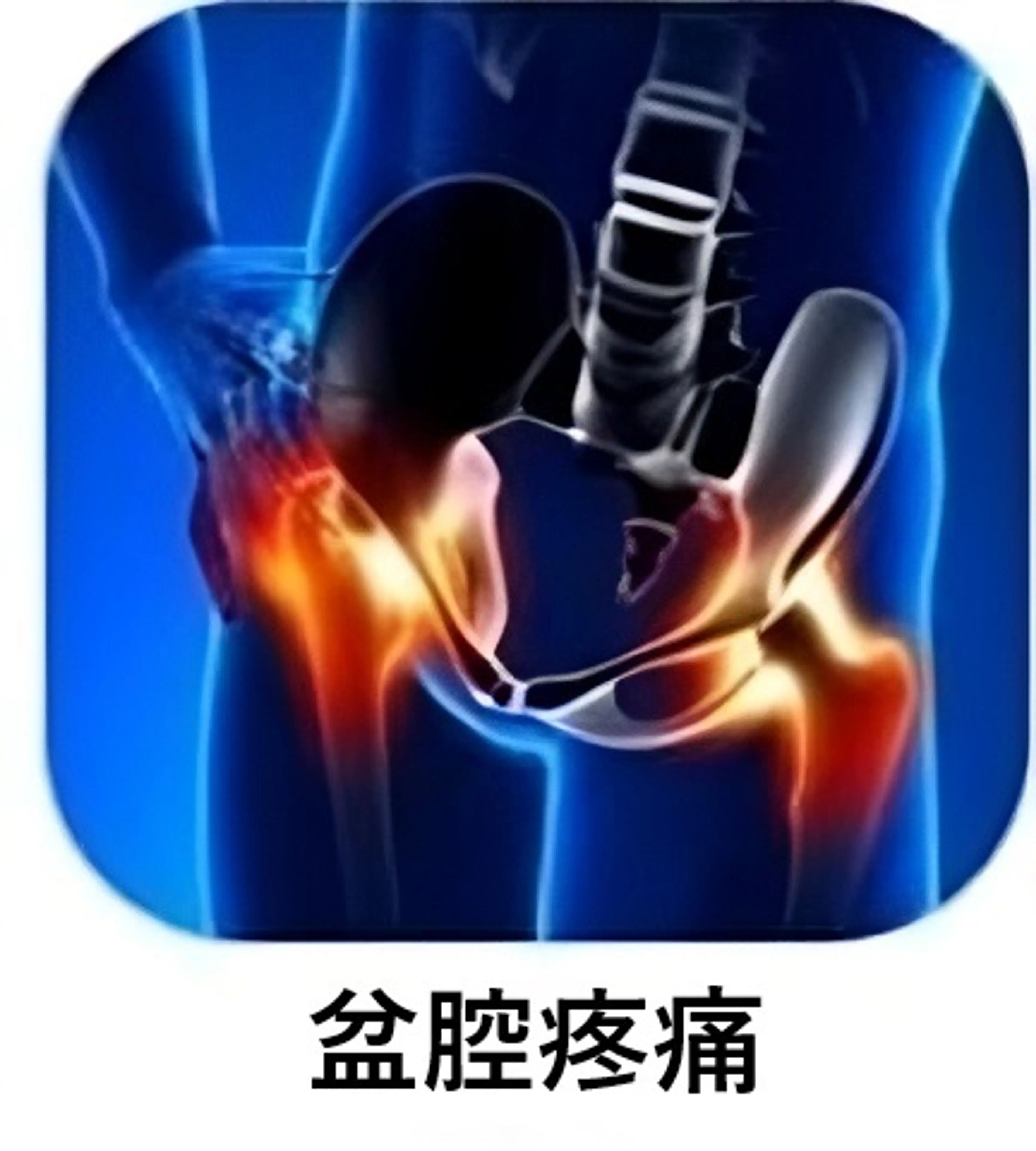 脊柱与姿势矫正