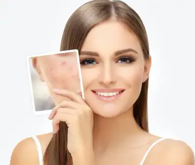 Điều trị da